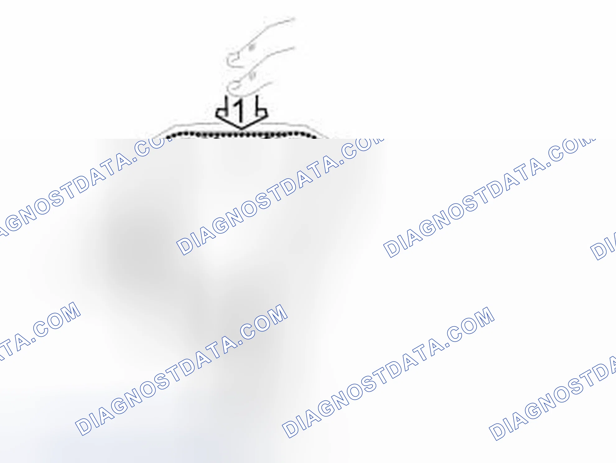 Scheme 142: Tensioning Of Cam Belt