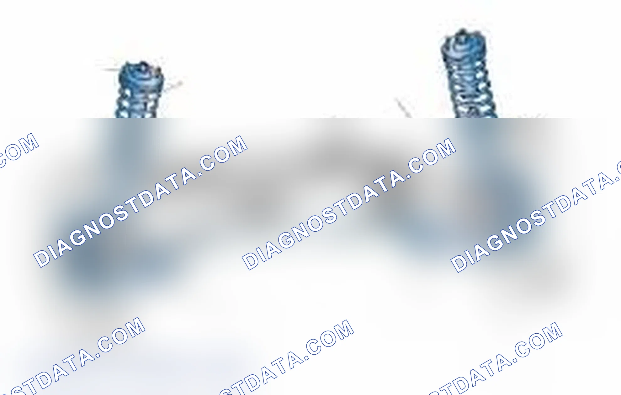Scheme 25: Typical Front Suspension & Steering Components