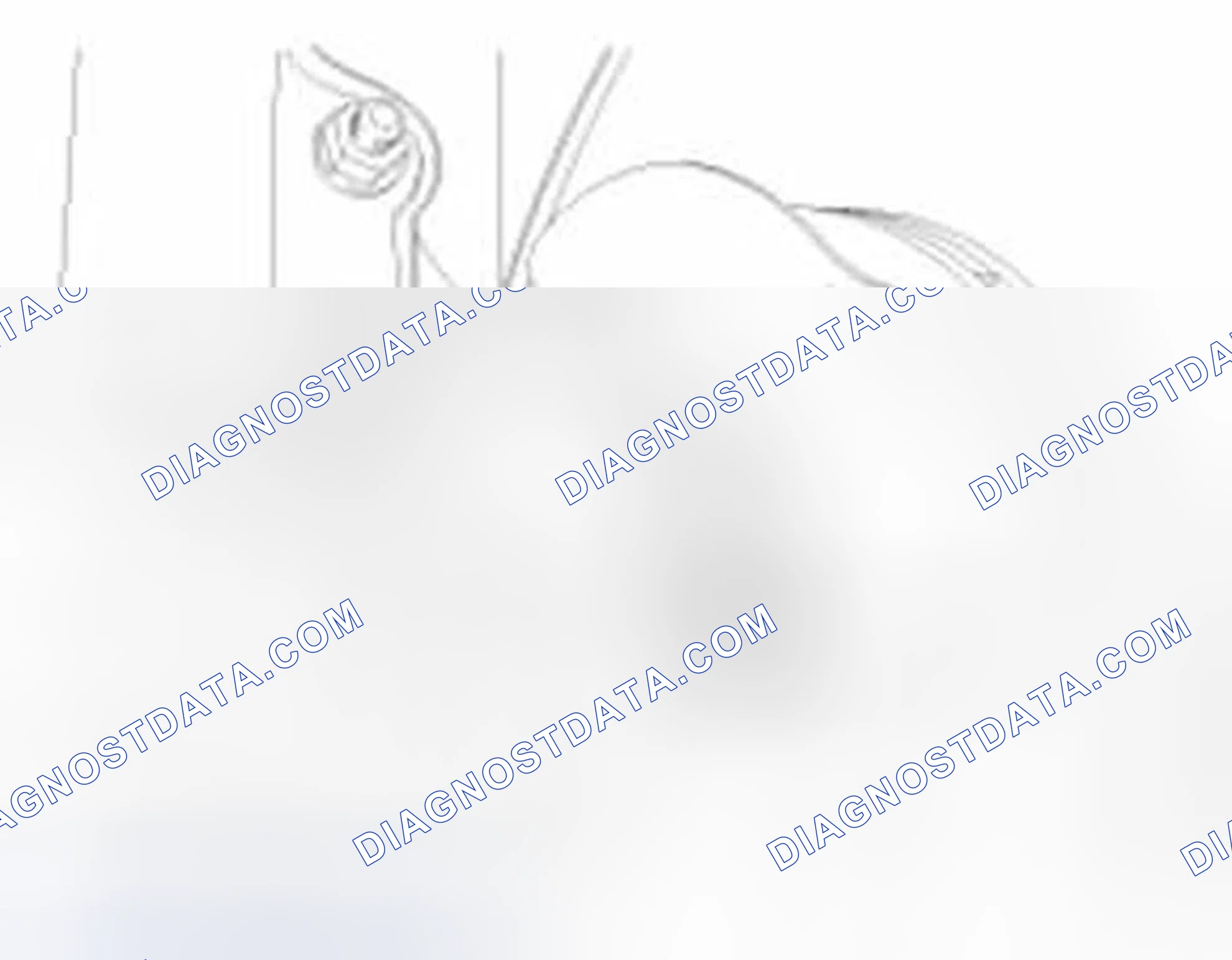 Scheme 17: Removal