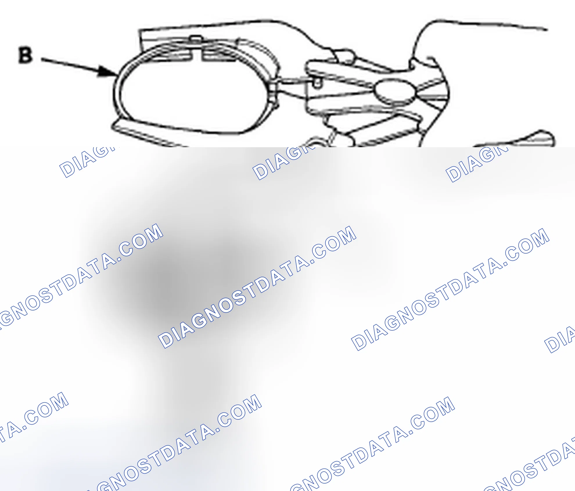 Scheme 465: Piston Ring Replacement