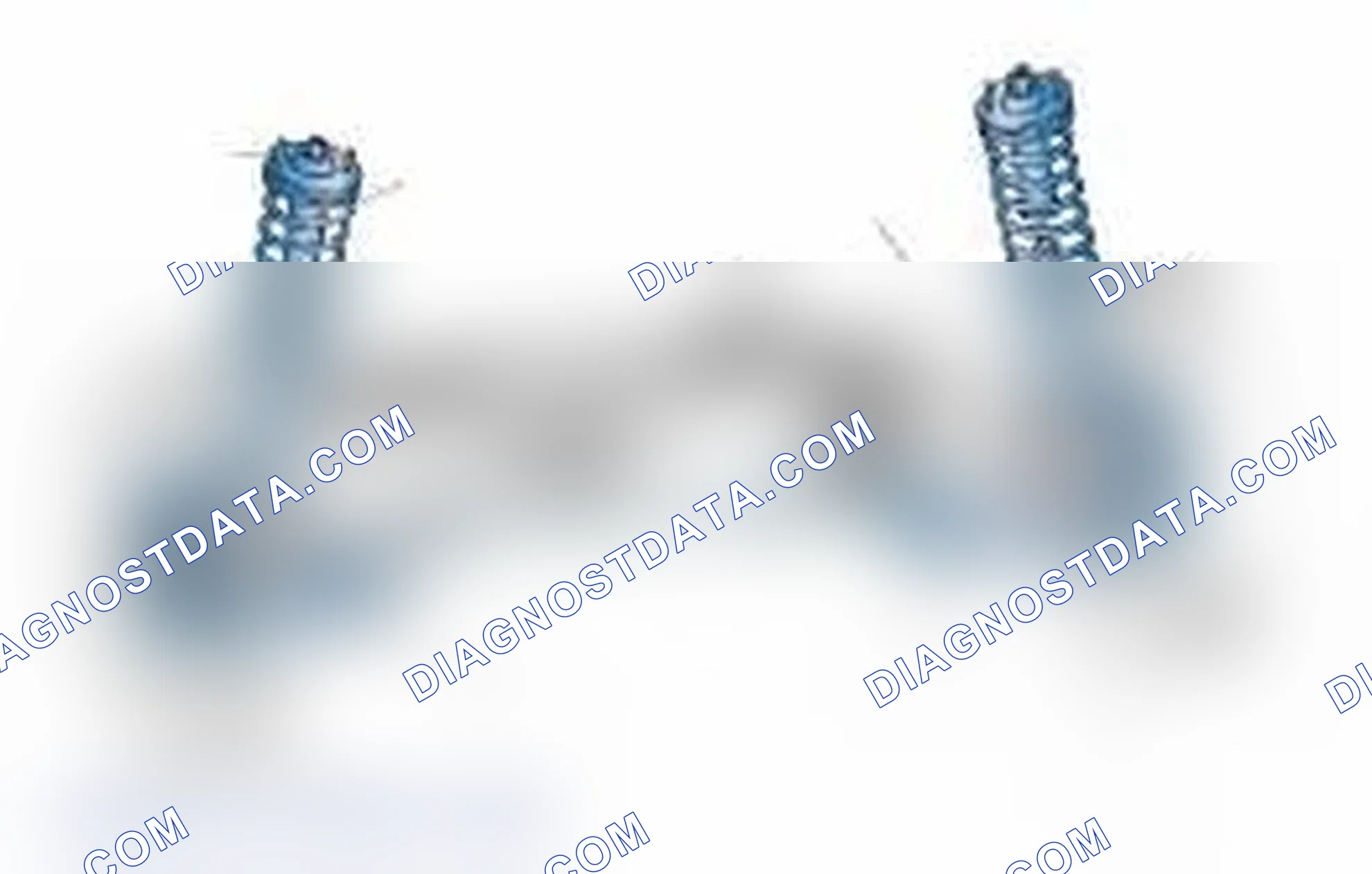 Scheme 25: Typical Front Suspension & Steering Components
