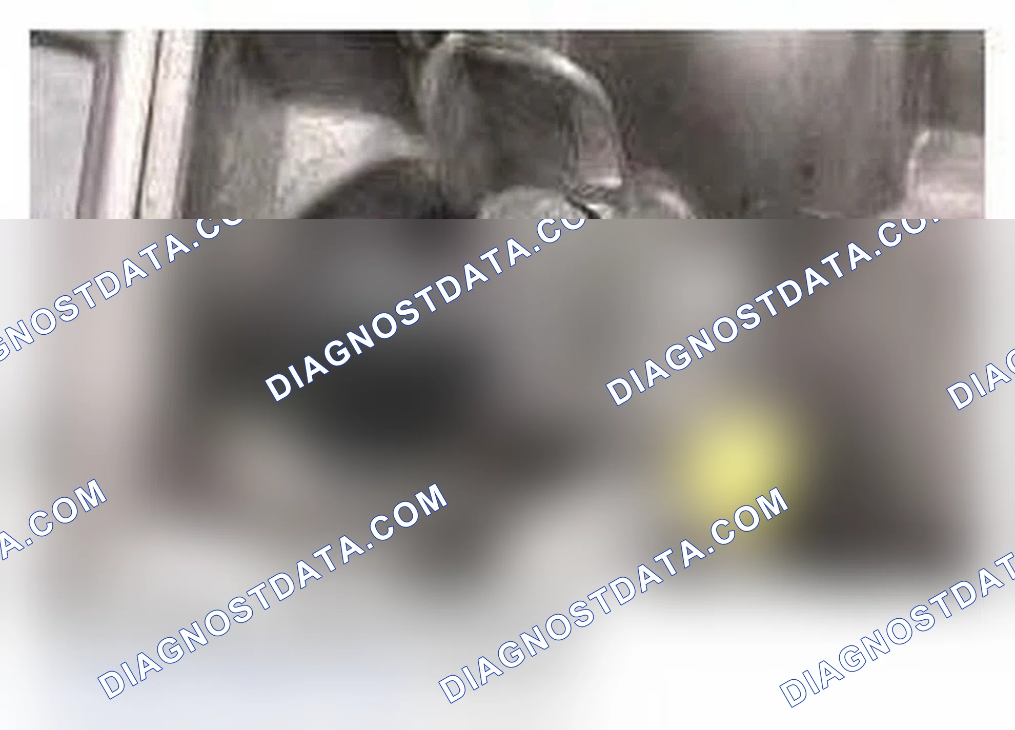 Scheme 151: Output Shaft Speed Sensor
