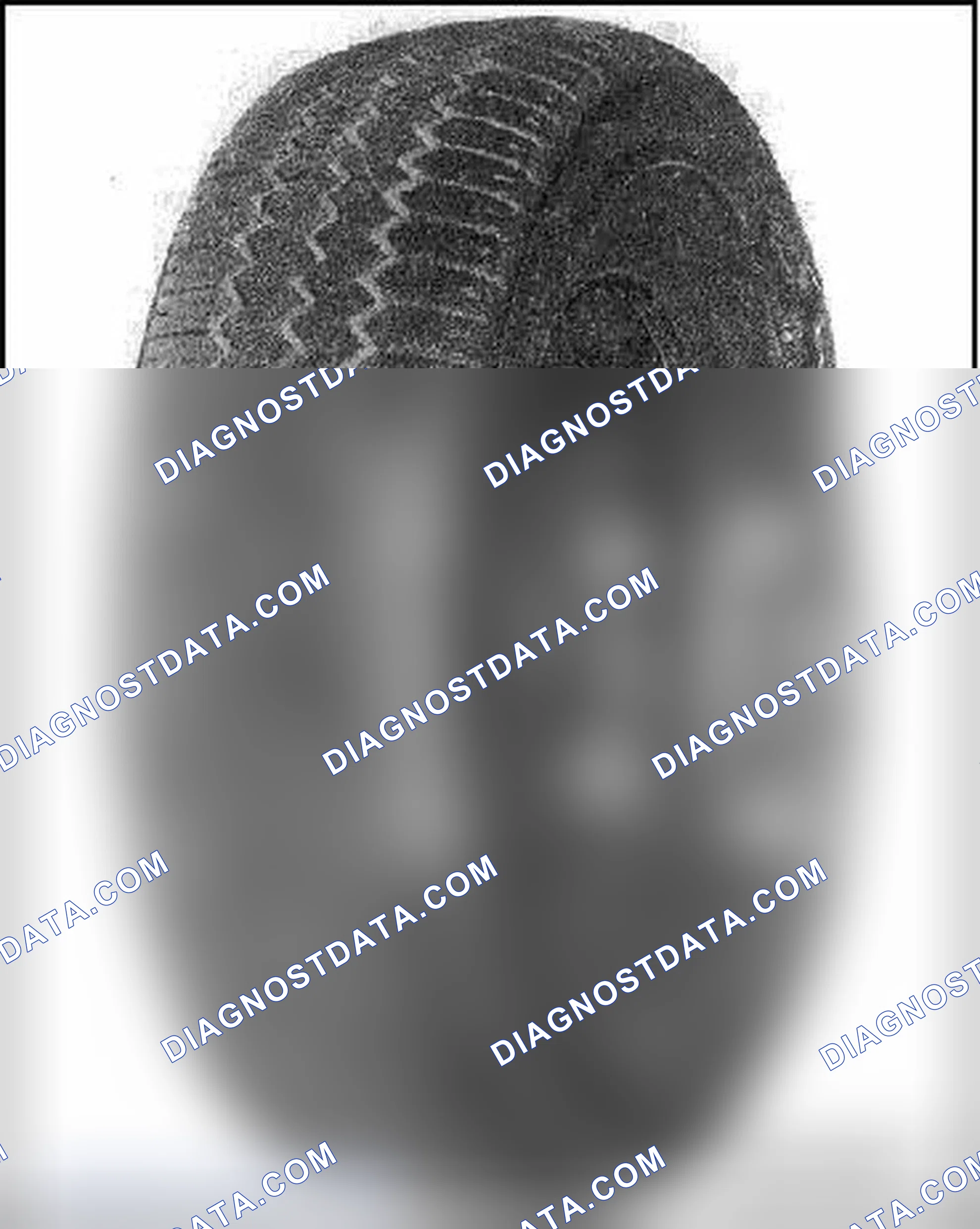 Scheme 34: TIRE DAMAGE FROM LOW TIRE PRESSURE