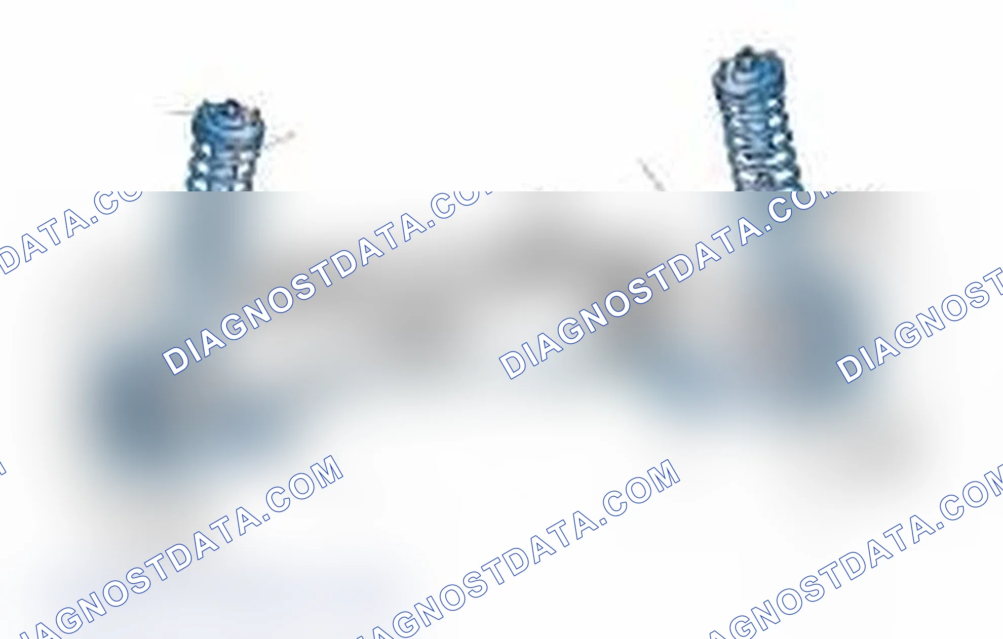 Scheme 25: Typical Front Suspension & Steering Components