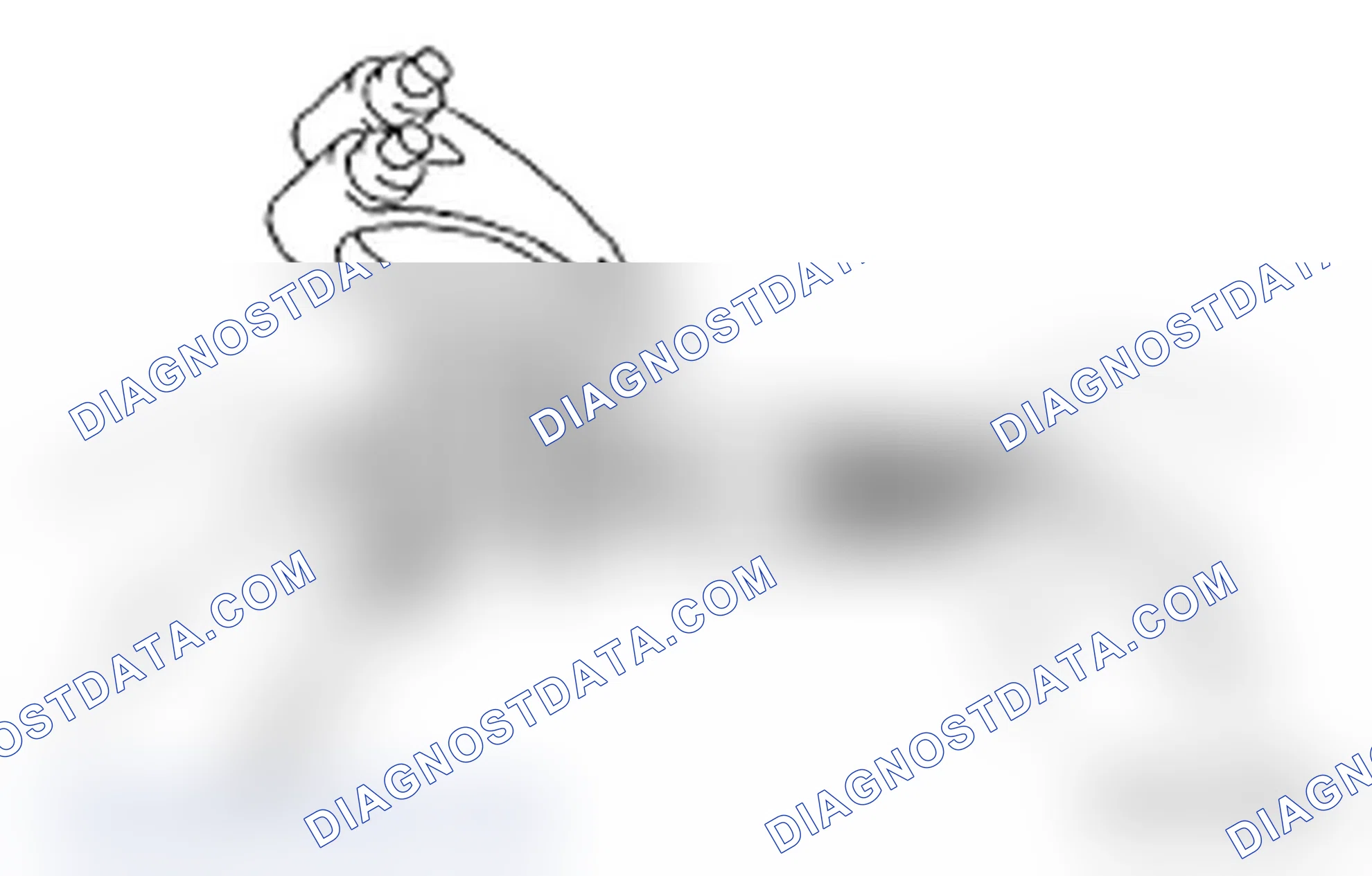 Scheme 148: EXHAUST VALVE ROCKER ASSEMBLY