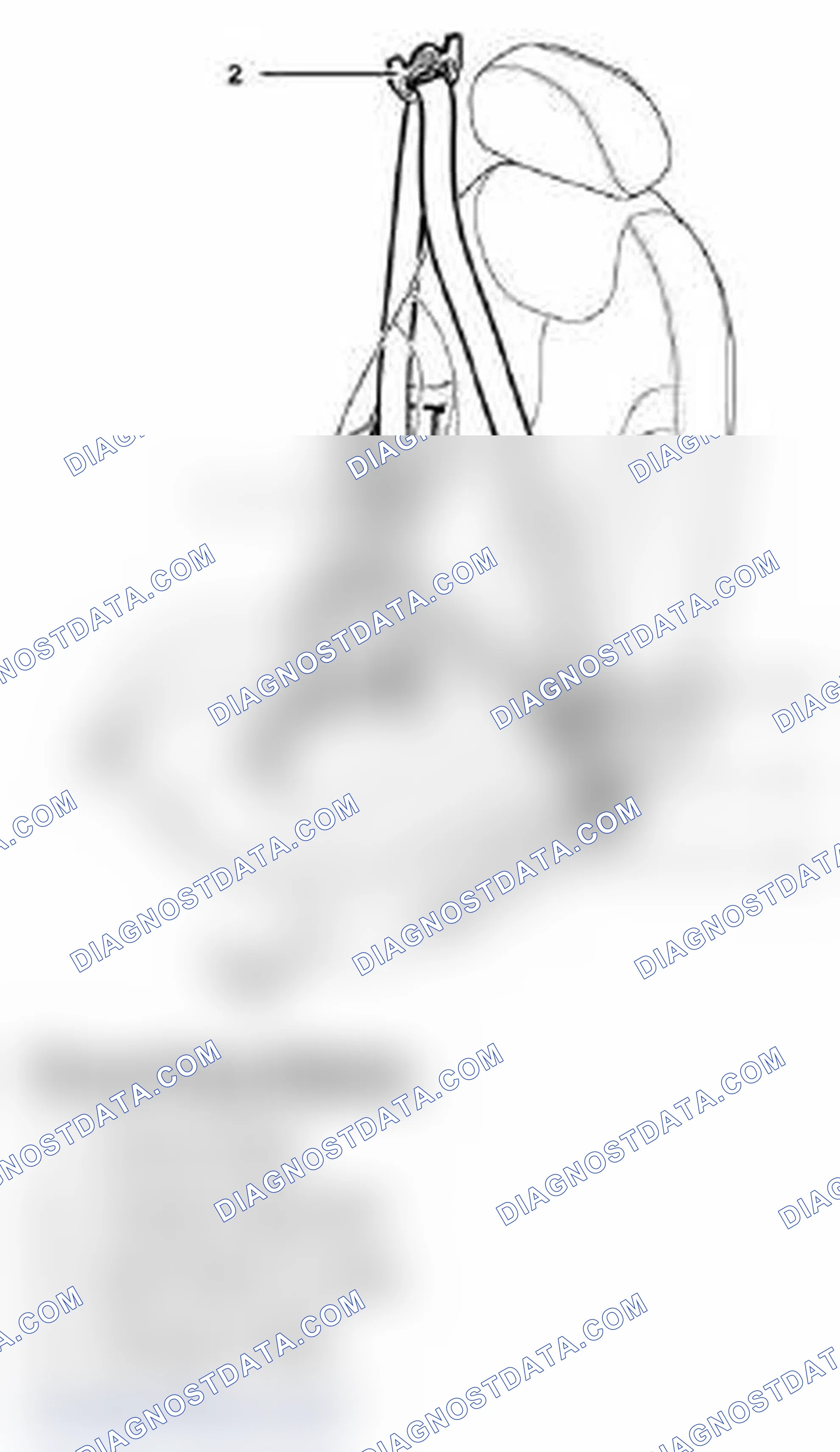 Scheme 20: Seat Belts