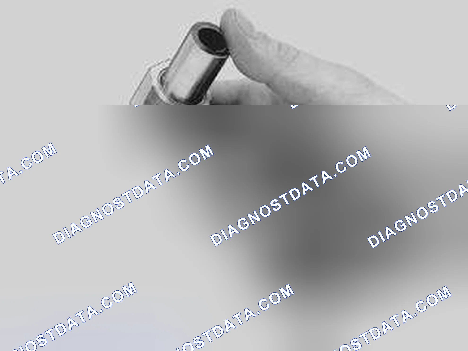 Scheme 243: CHECKING THE ALIGNMENT OF THE PISTON PINS IN THE CONNECTING RODS