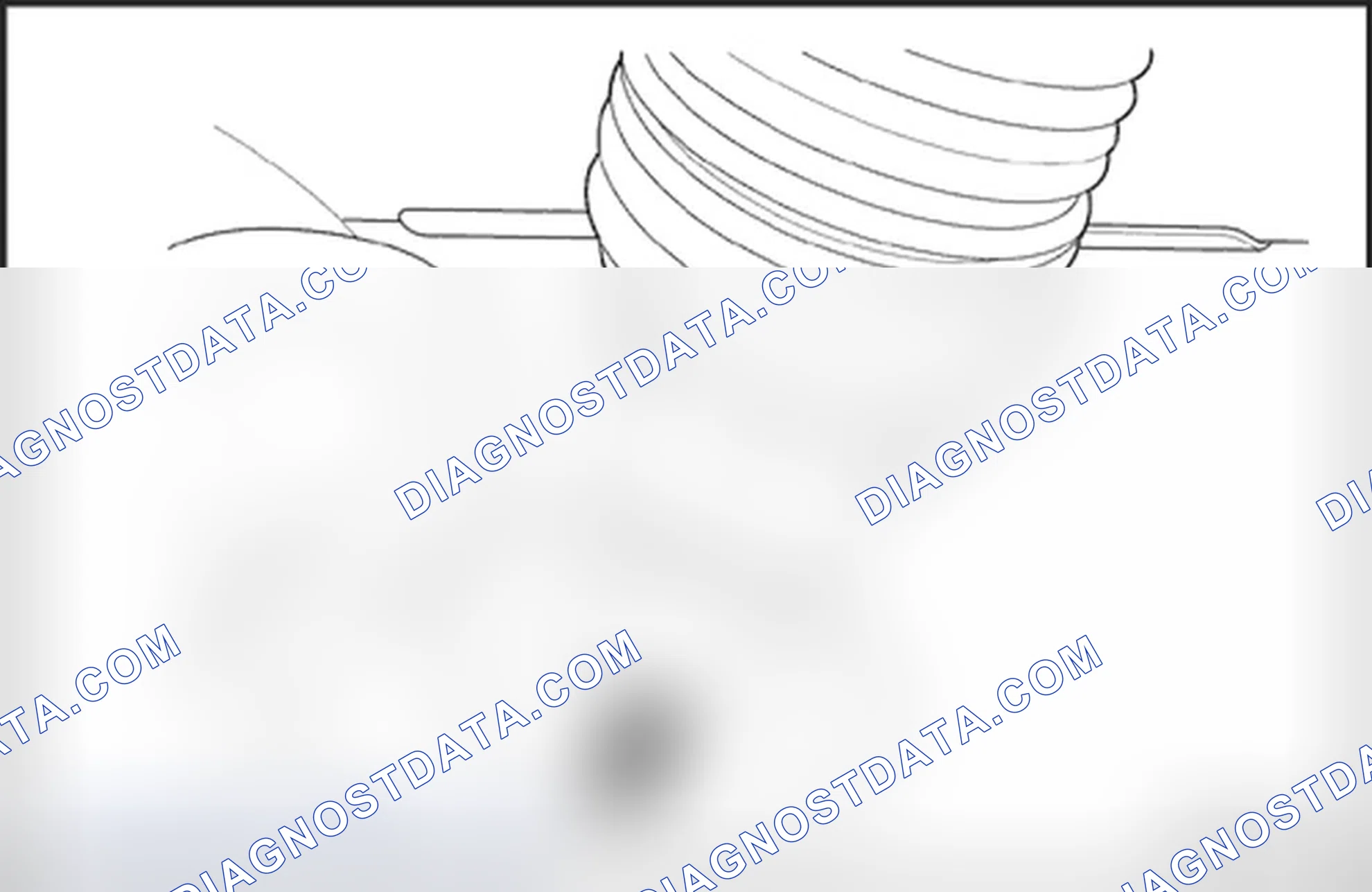 Rack and Pinion Assembly Replace
