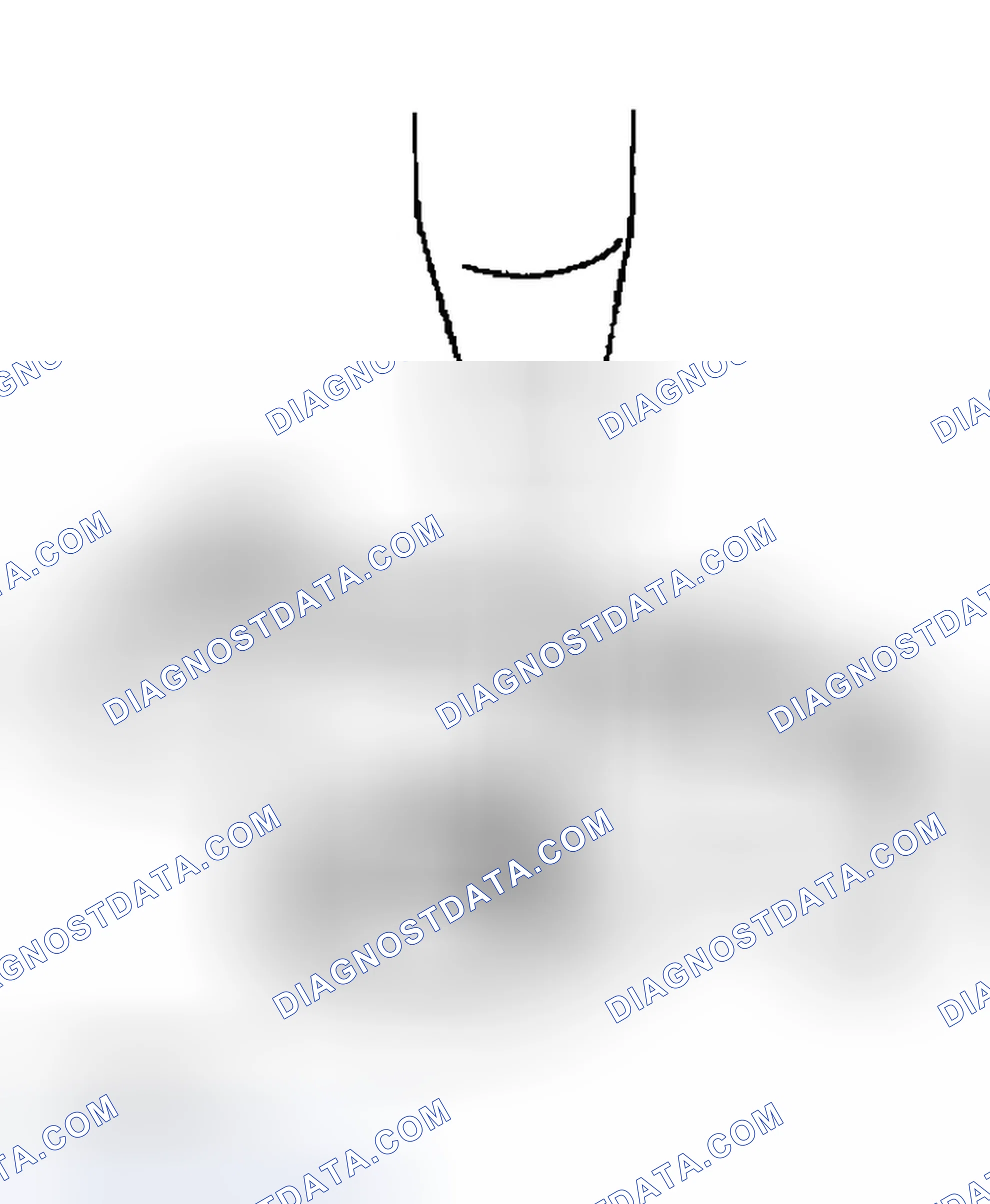Scheme 121: CAMSHAFT OIL SEAL HOUSING DISASSEMBLY NOTE