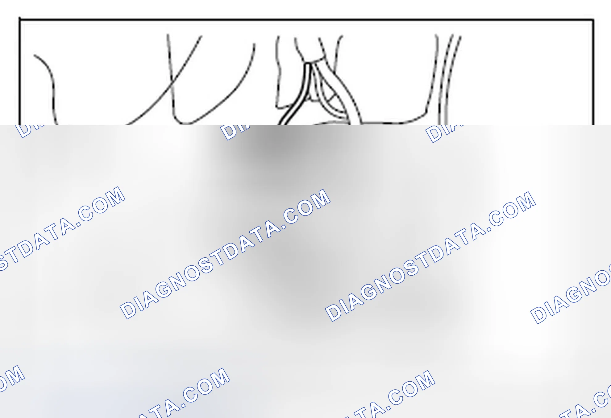 Scheme 10: Removal