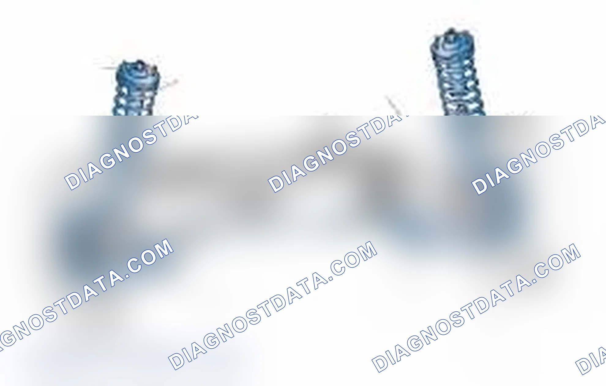 Scheme 25: Typical Front Suspension & Steering Components