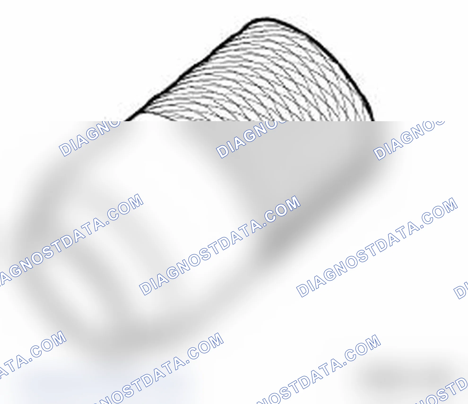 Scheme 4: 0493420 230190 Bush Minimum set: Mechanical tools MW