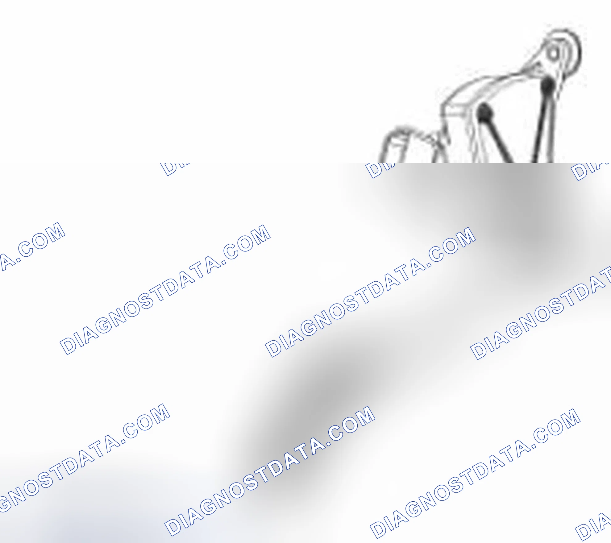 Scheme 18: 3-Track APP Sensor