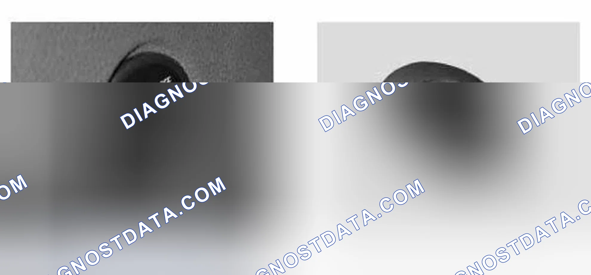 Scheme 12: Airbag Switch