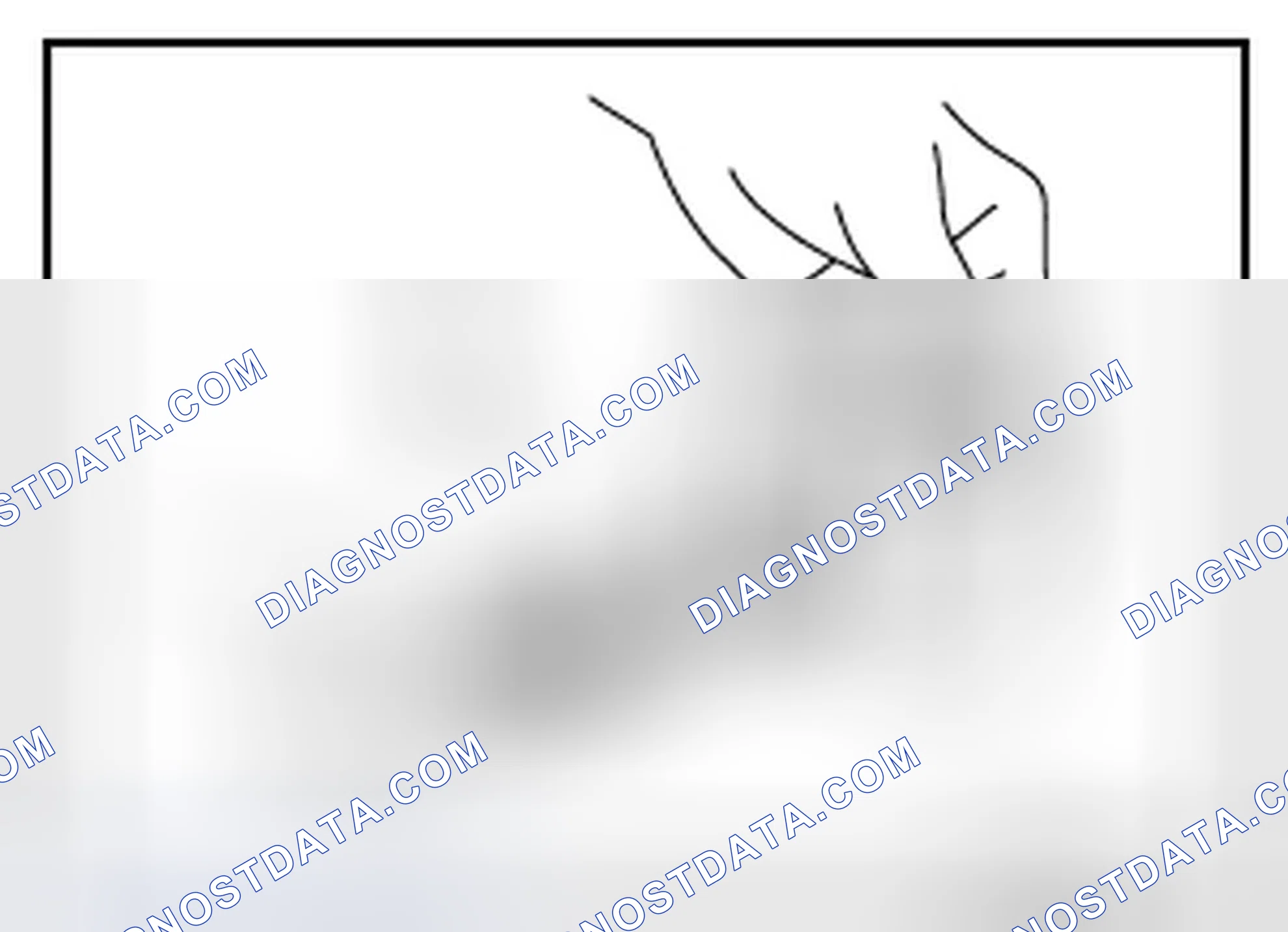 Scheme 197: Piston Pin Outer Diameter
