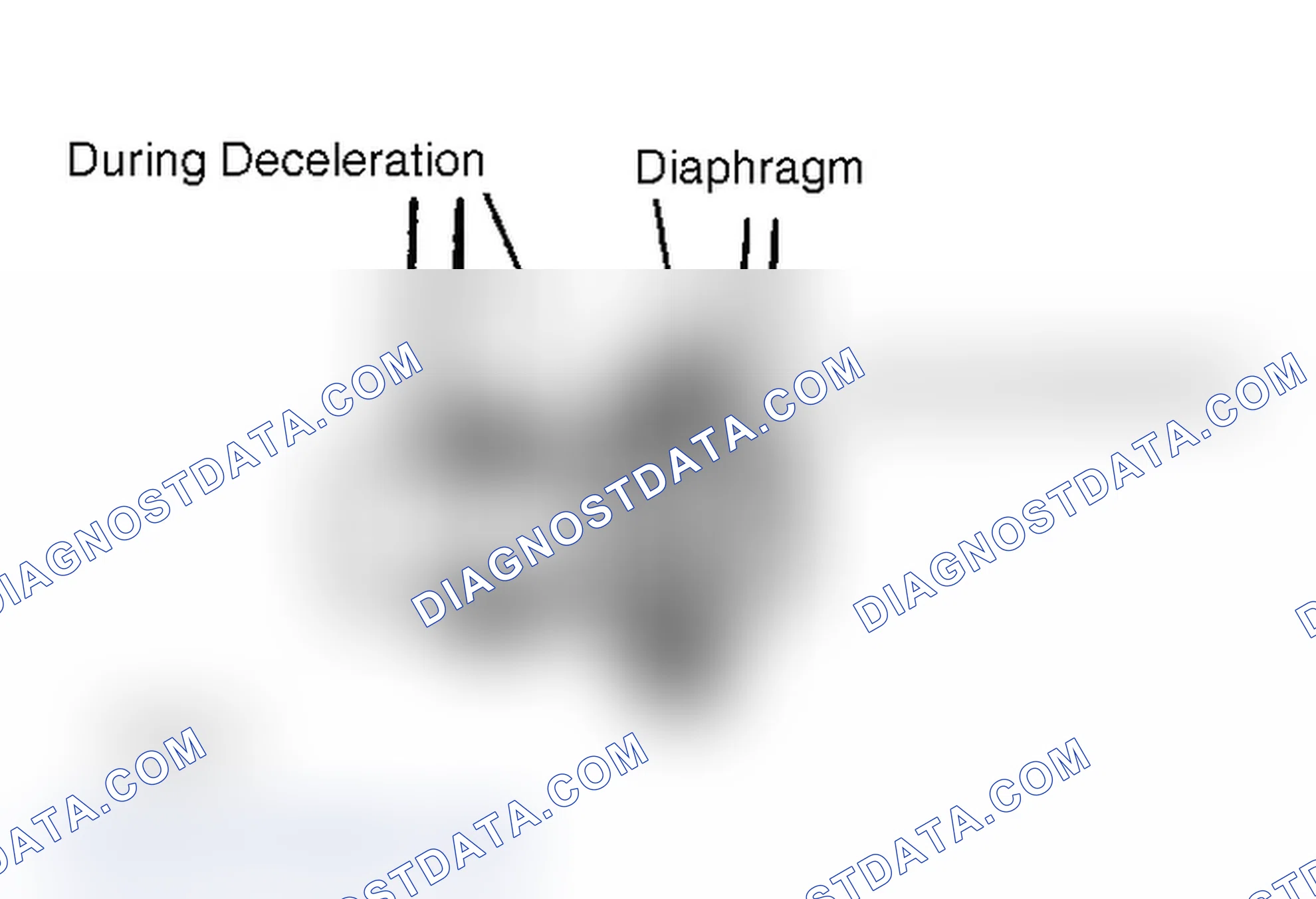 Scheme 13: Checking EGR Valve Diaphragm Movement