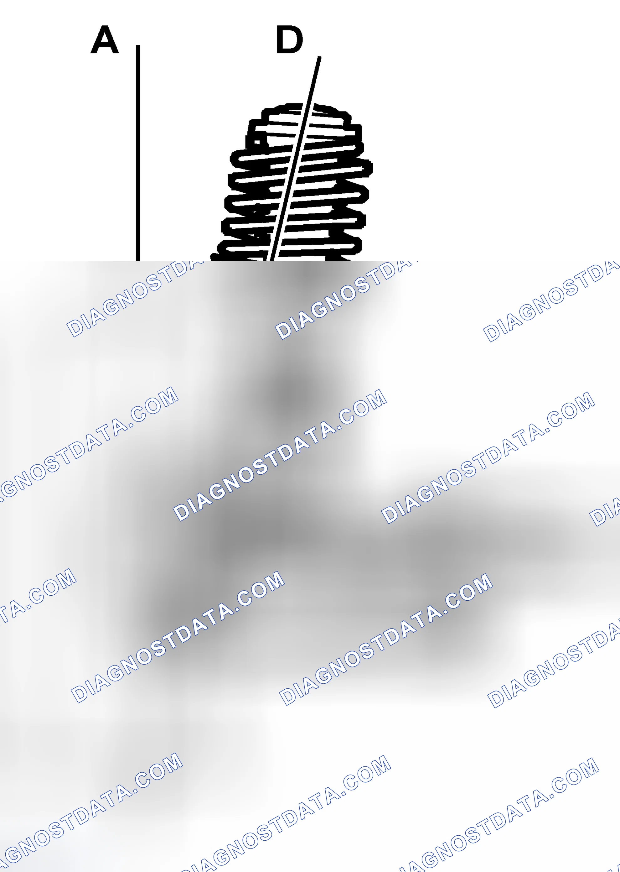 Scheme 117: Swivel pin inclination