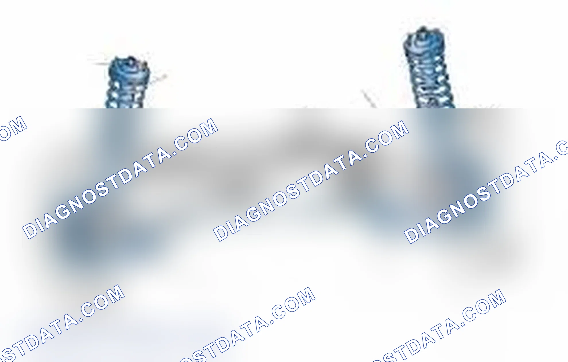 Scheme 25: Typical Front Suspension & Steering Components