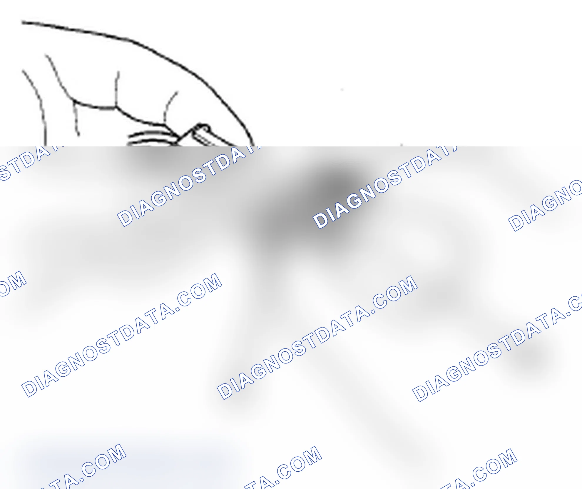 Scheme 20: Disconnecting