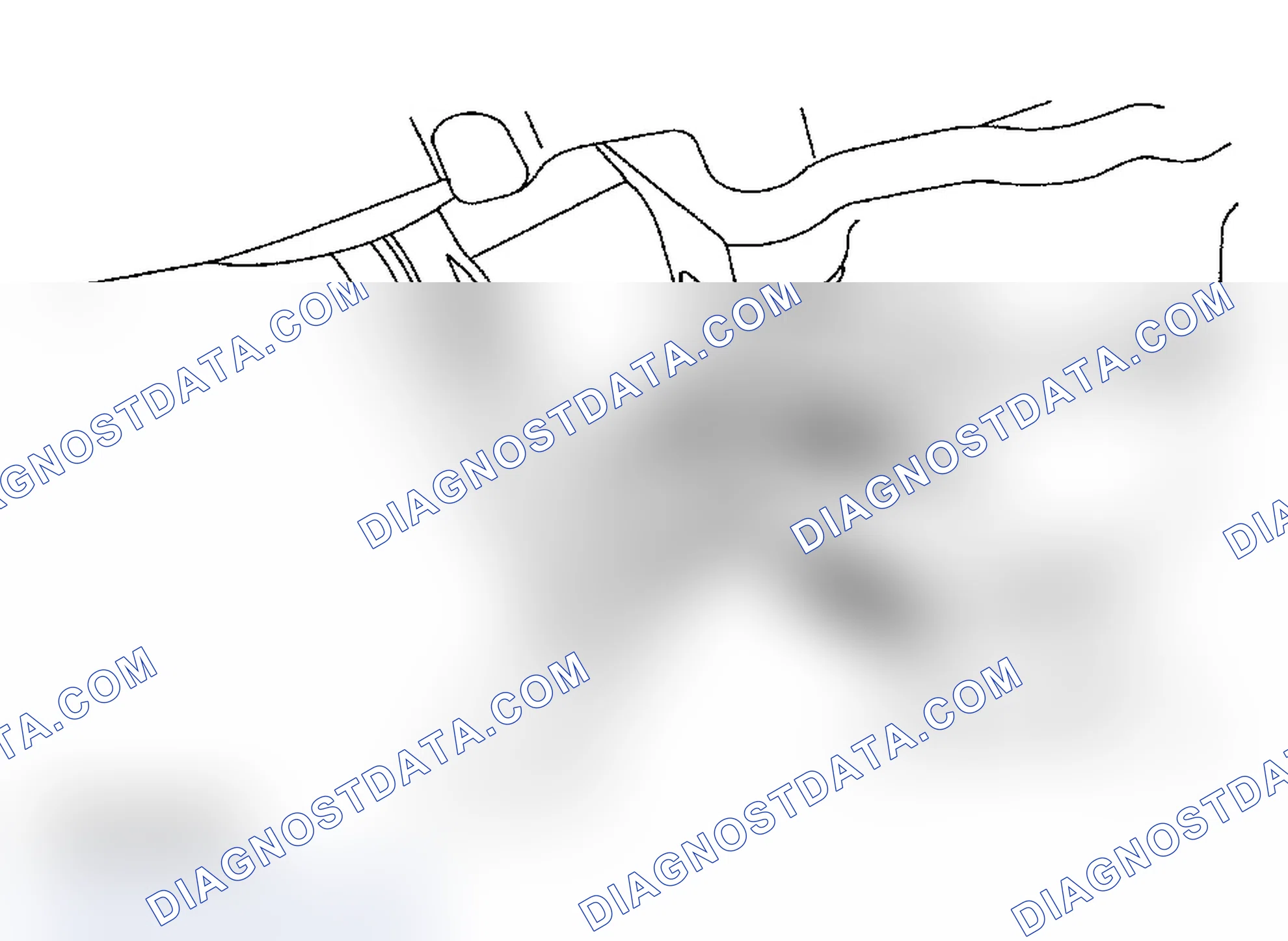 Scheme 2: Removal and Installation