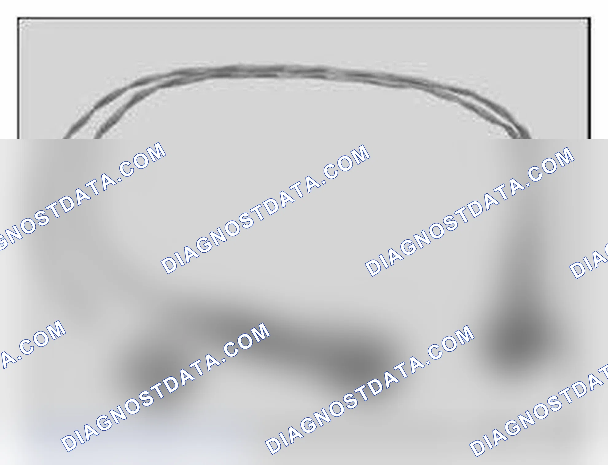 Scheme 1072: 61 4 370 V-adapter lead (2-pin), zero-coded