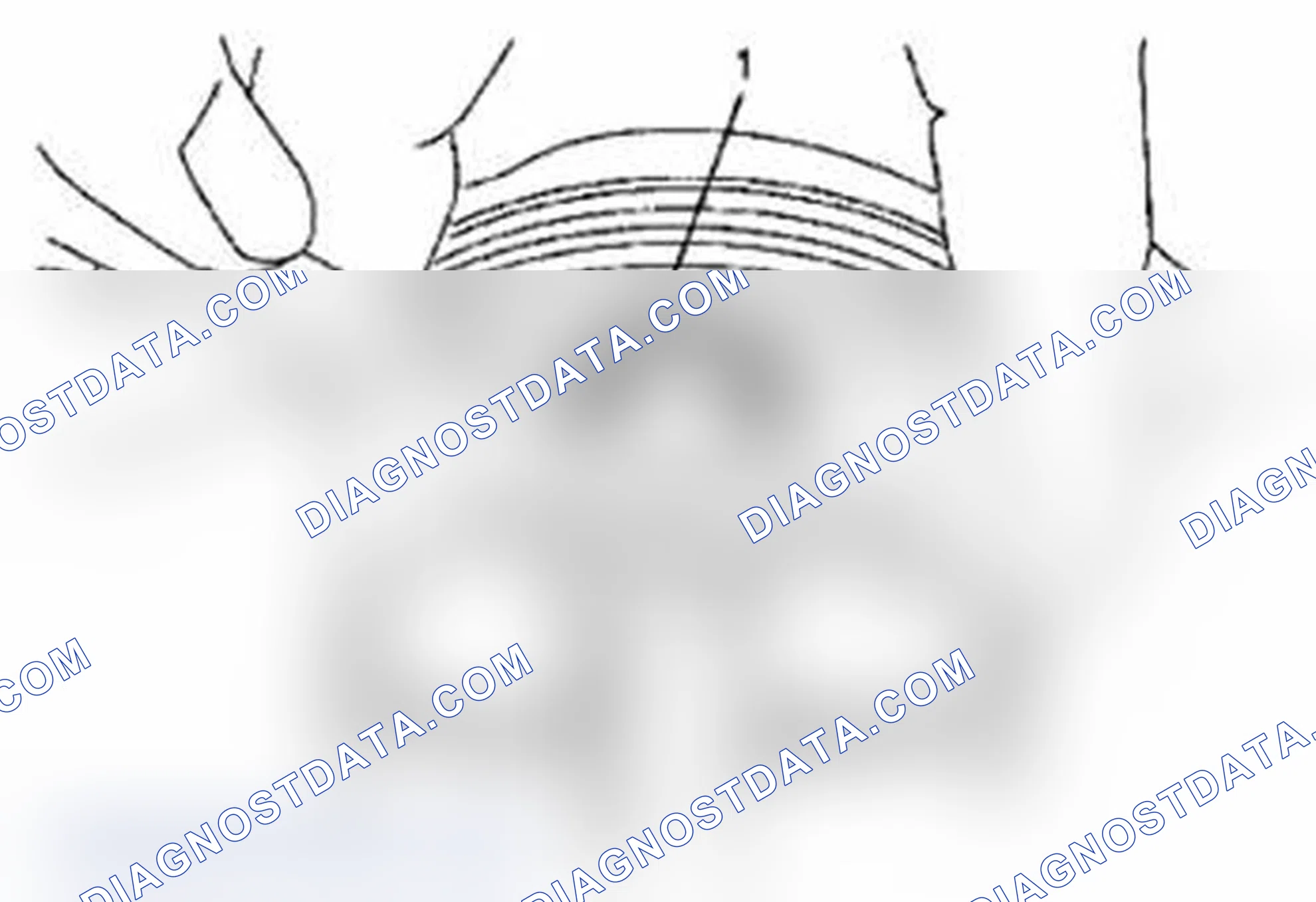 Scheme 154: Disassembly