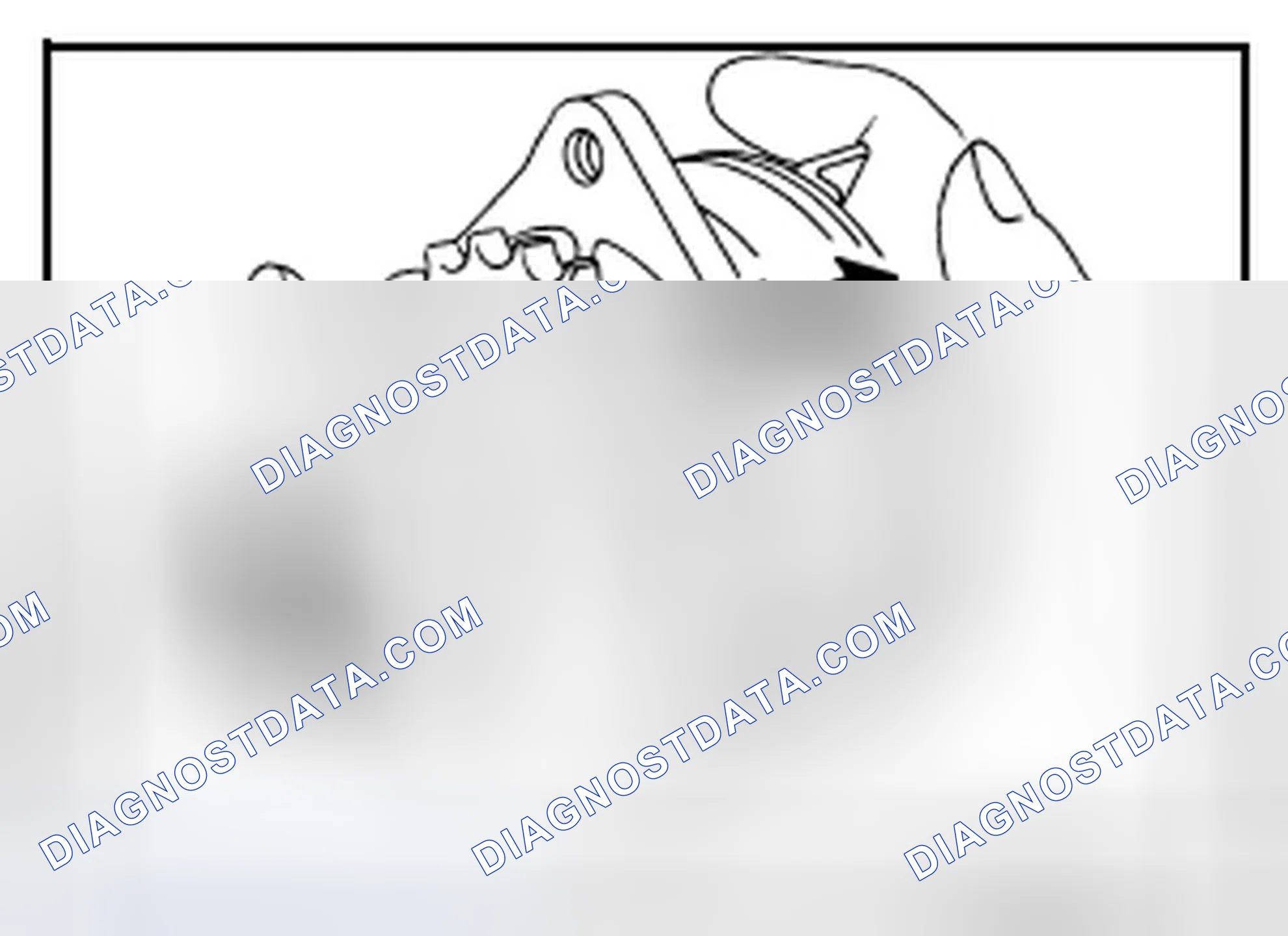 Scheme 20: INSPECTION AFTER REMOVAL