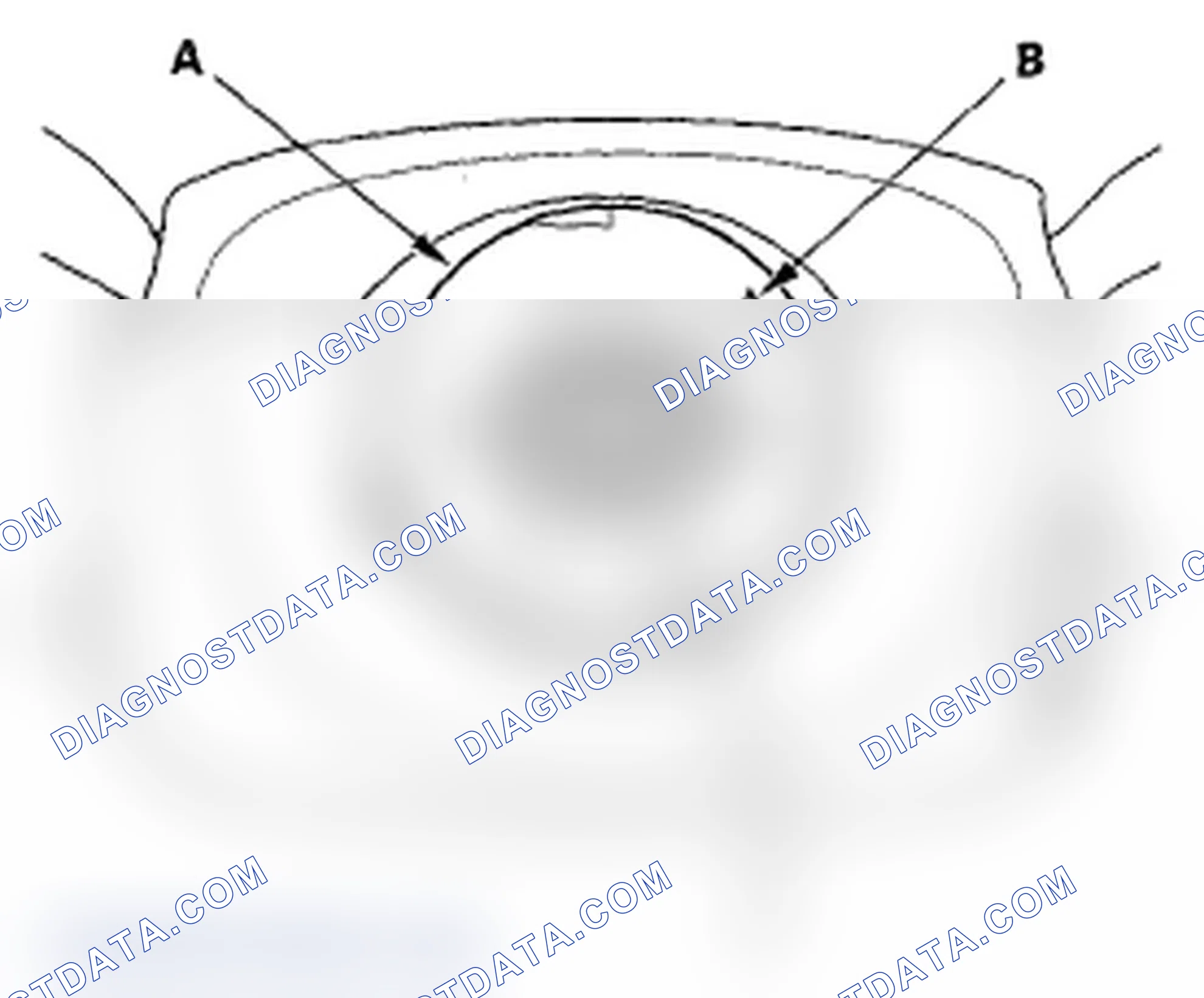 Scheme 37: Steering Wheel Installation