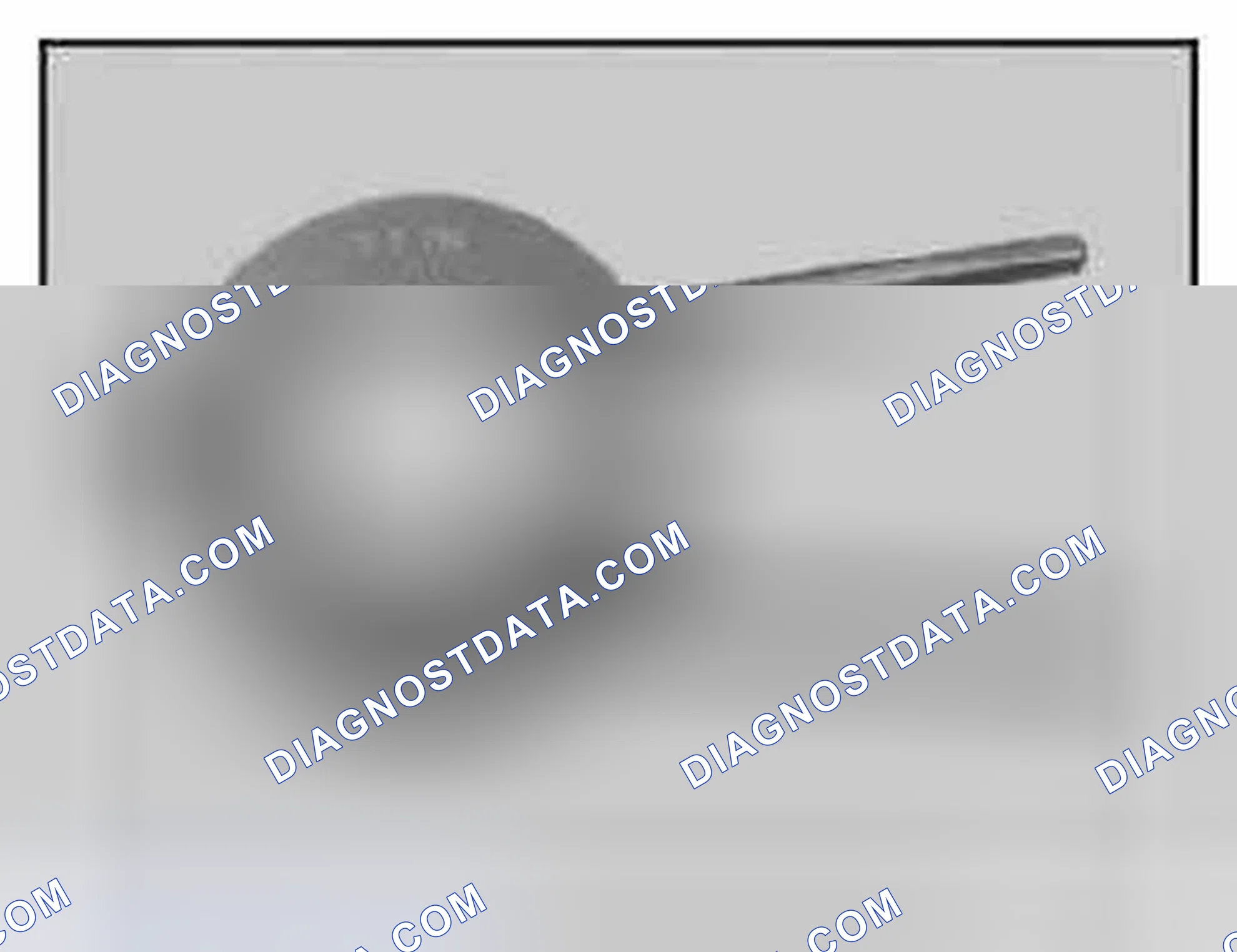 Scheme 801: 11 7 280 Piston ring pliers