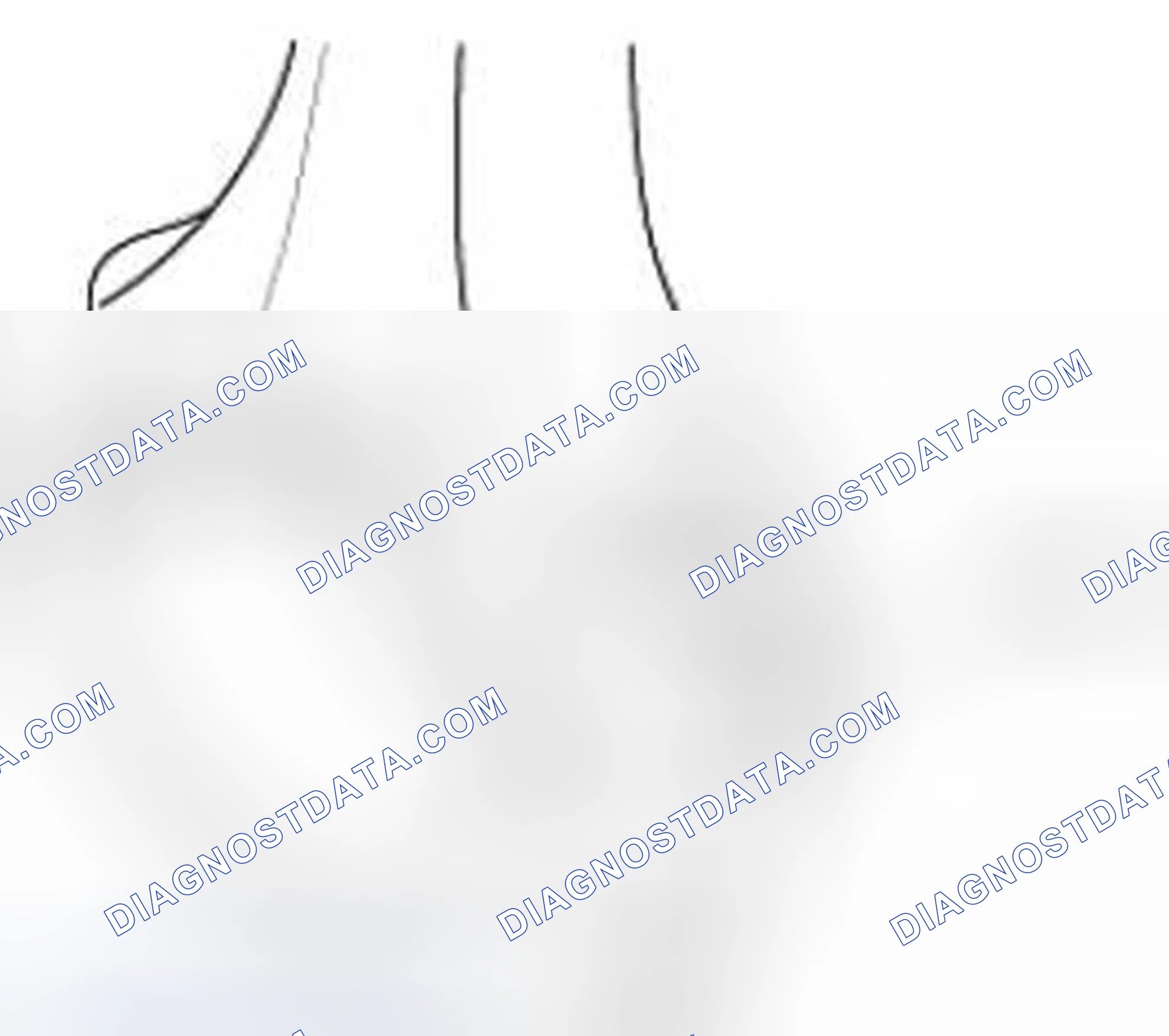 Scheme 189: Connecting rod mark location