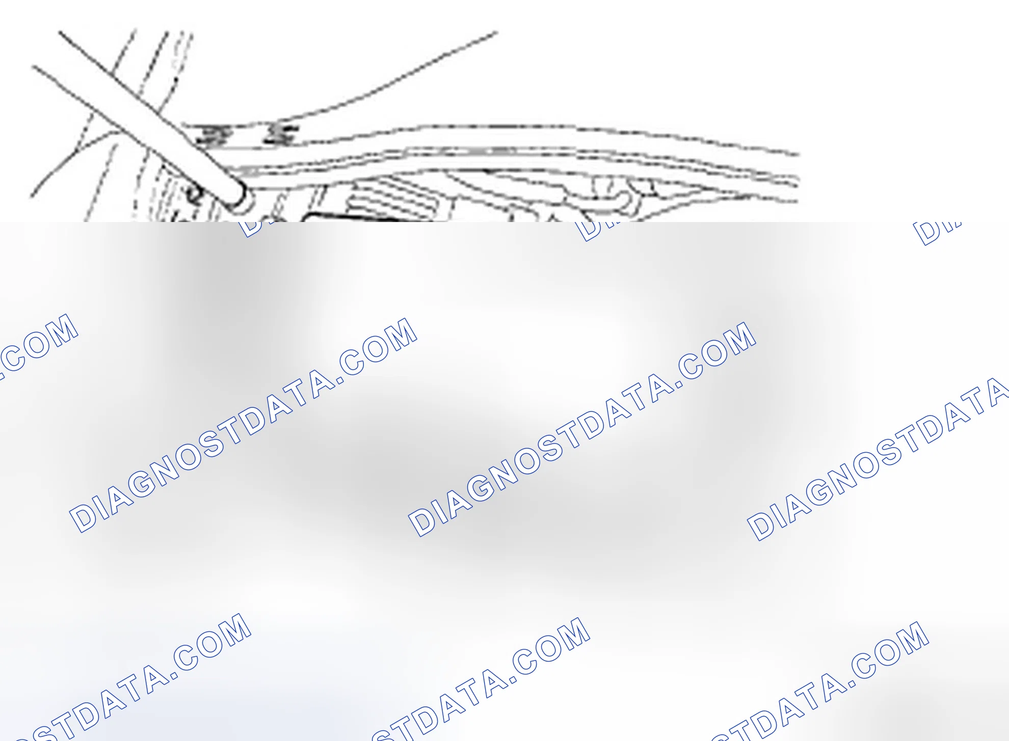 Scheme 73: REPLACEMENT