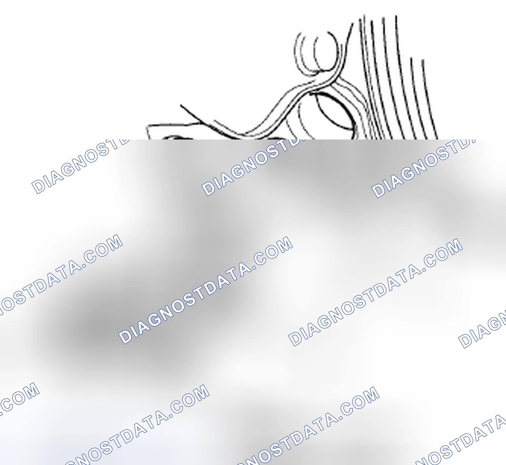 Scheme 699: CKP Sensor Replacement