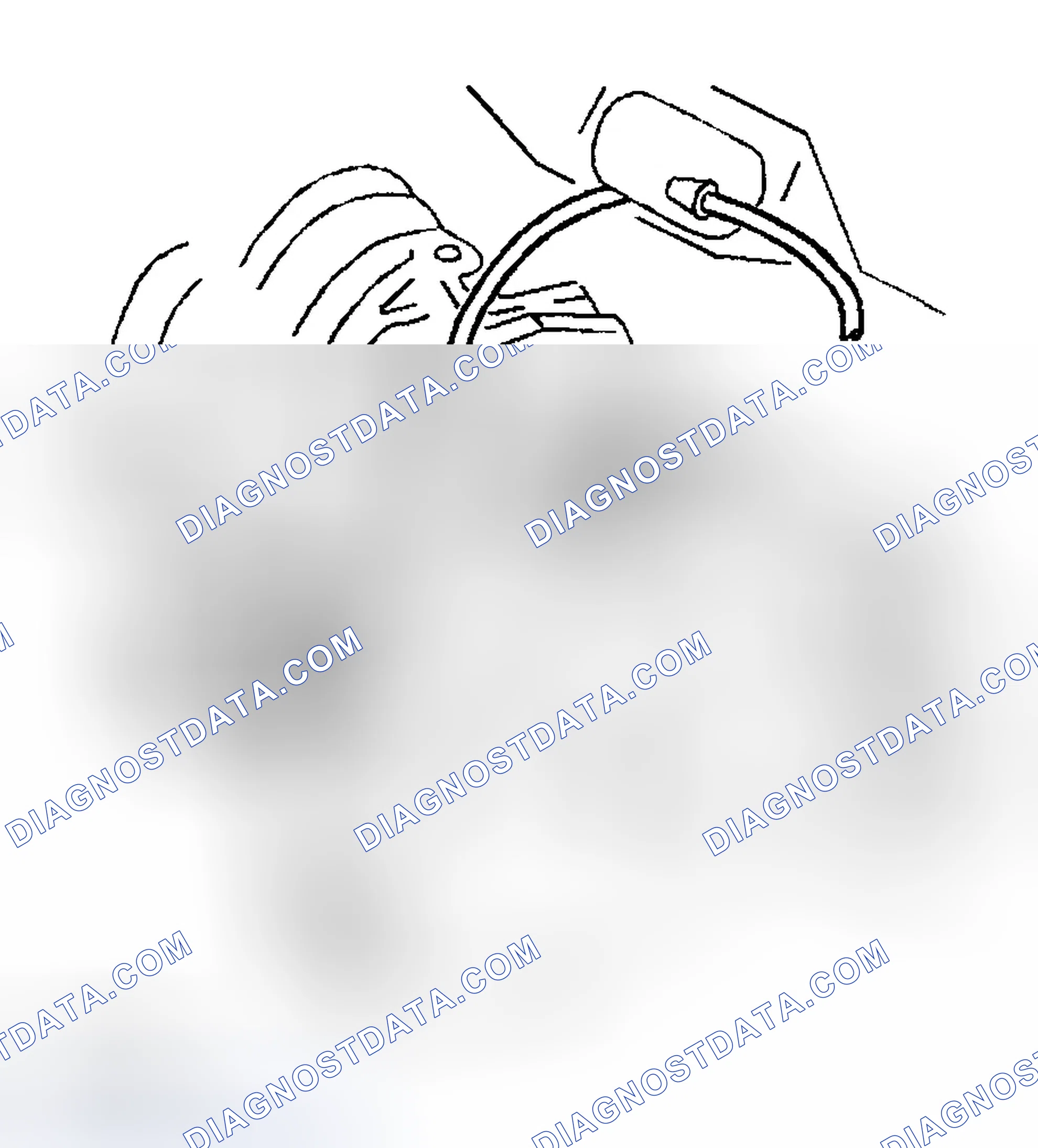 Scheme 278: Removal Procedure