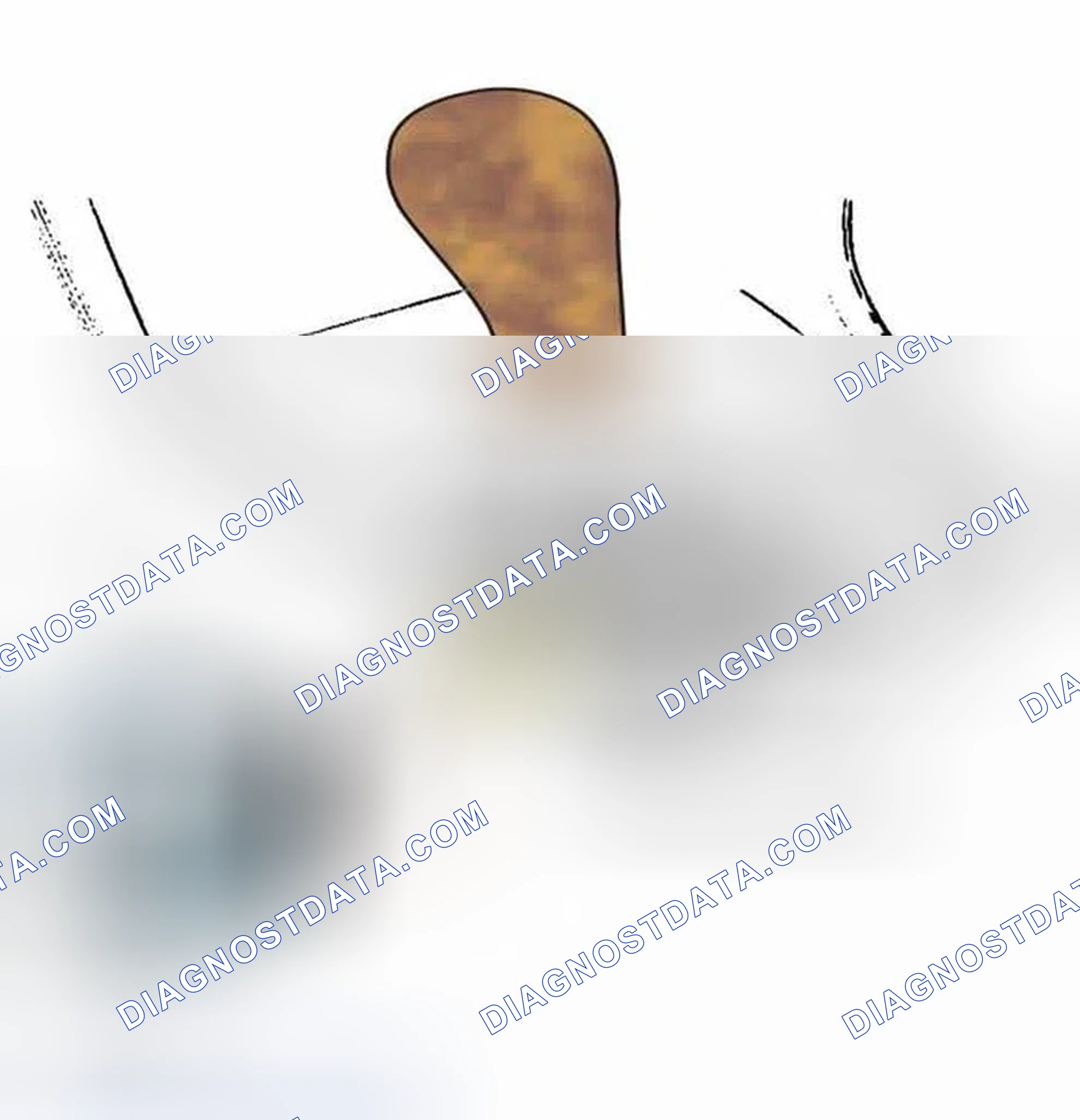 Scheme 215: SHIFT LOCK