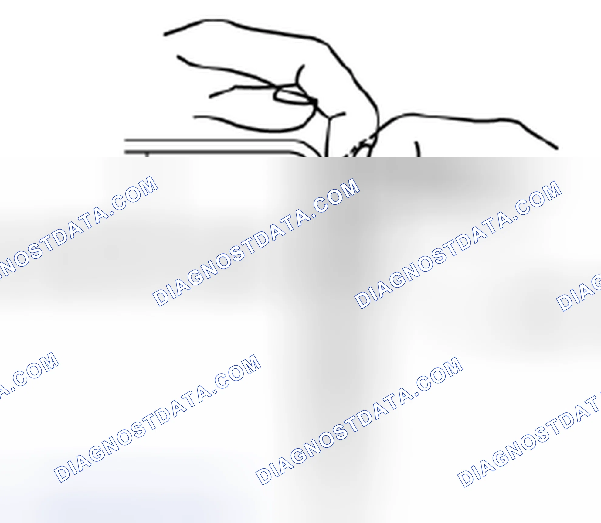 Scheme 59: Pulling Battery Clips