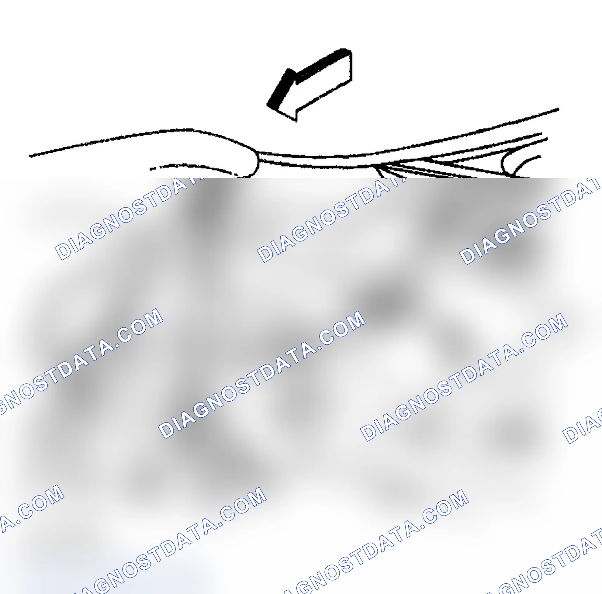 Scheme 21: Removal Procedure