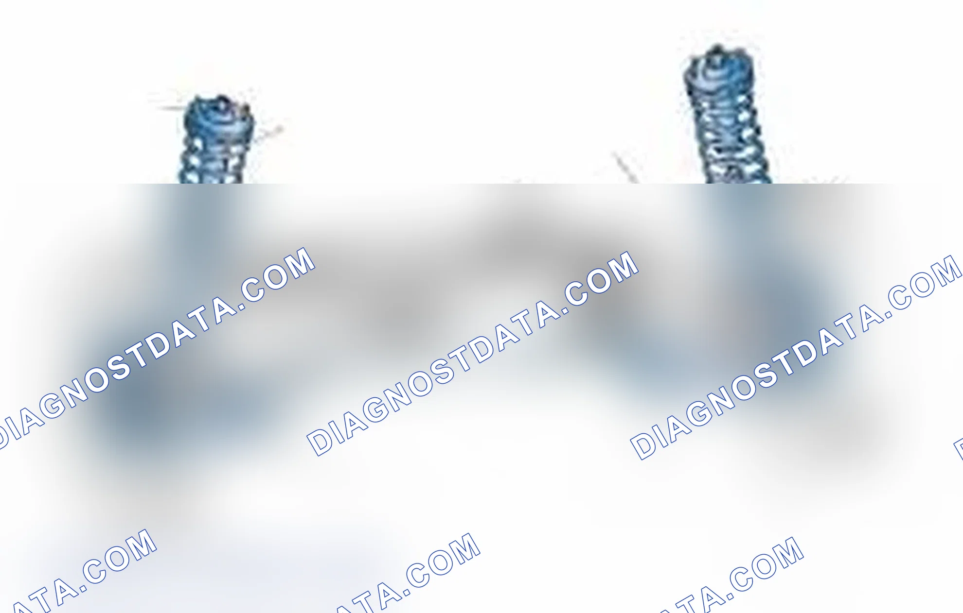 Scheme 25: Typical Front Suspension & Steering Components
