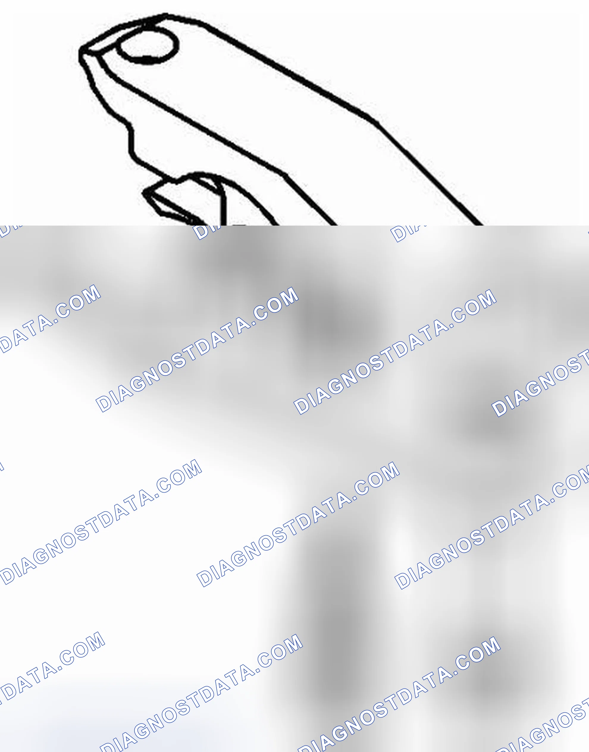 Scheme 1: Special Tools