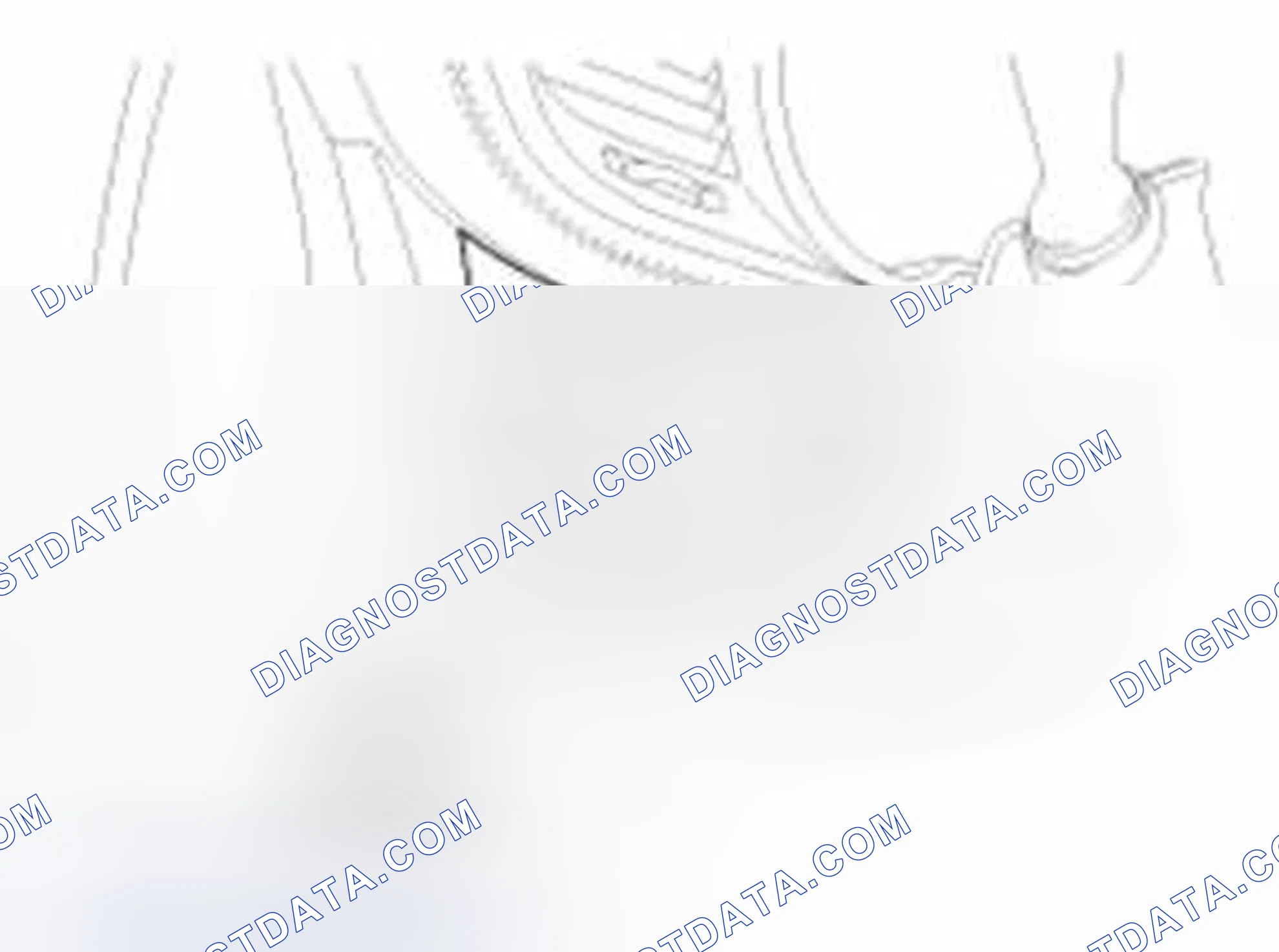 Scheme 17: Inspection