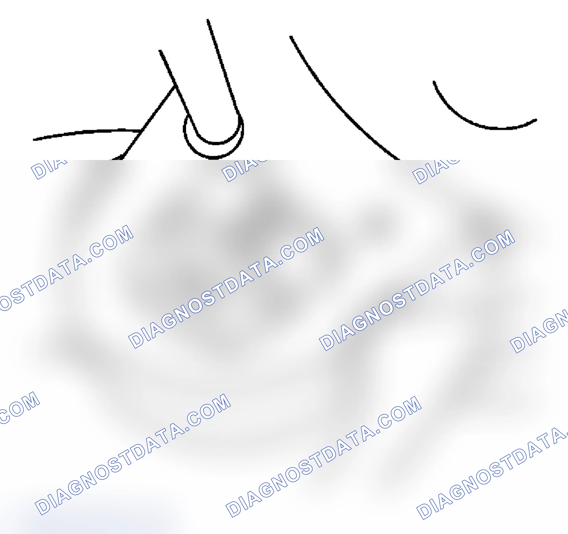 Scheme 20: Removal Procedure