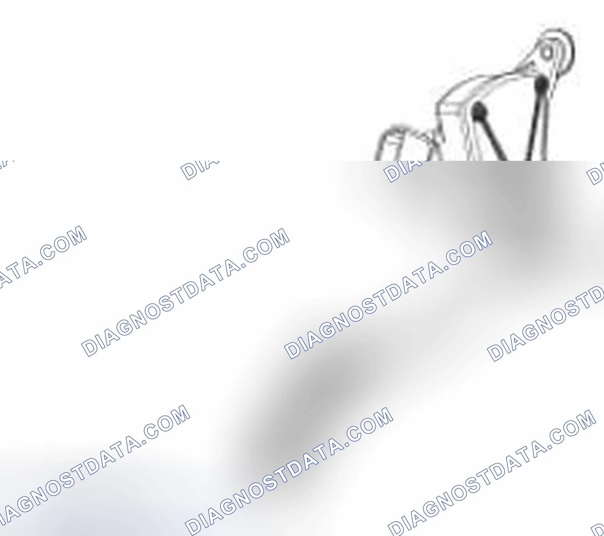 Scheme 18: 3-Track APP Sensor