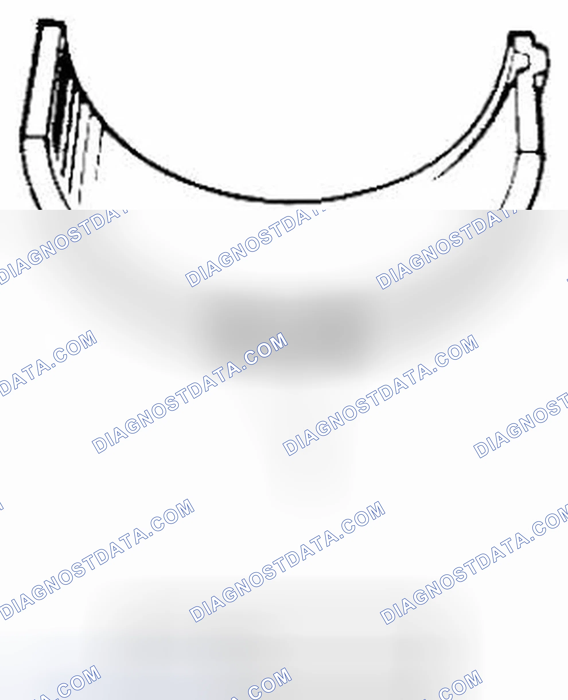 Scheme 230: Undersize bearing (0.25 mm (0.0098 in.))