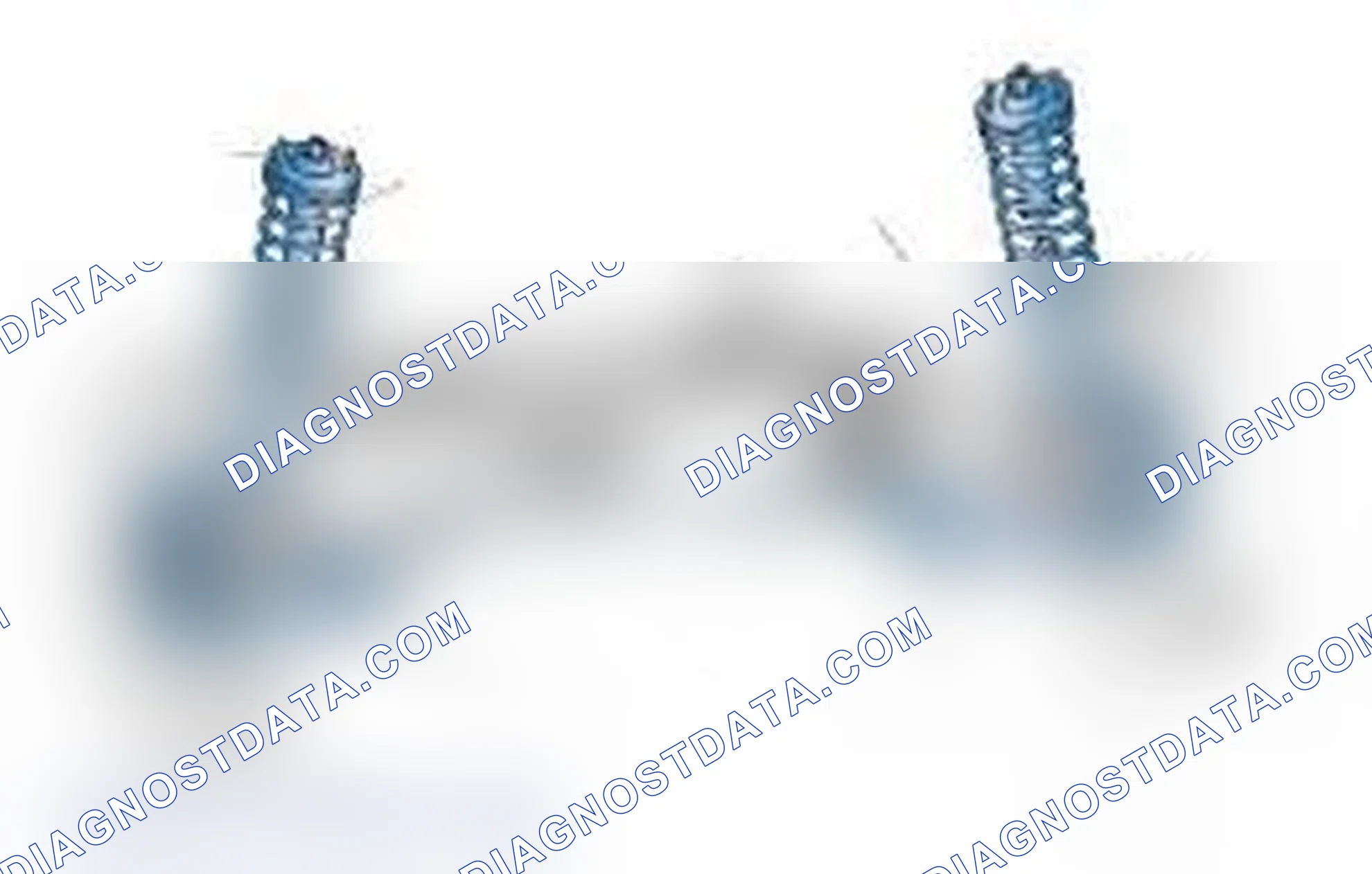 Scheme 25: Typical Front Suspension & Steering Components