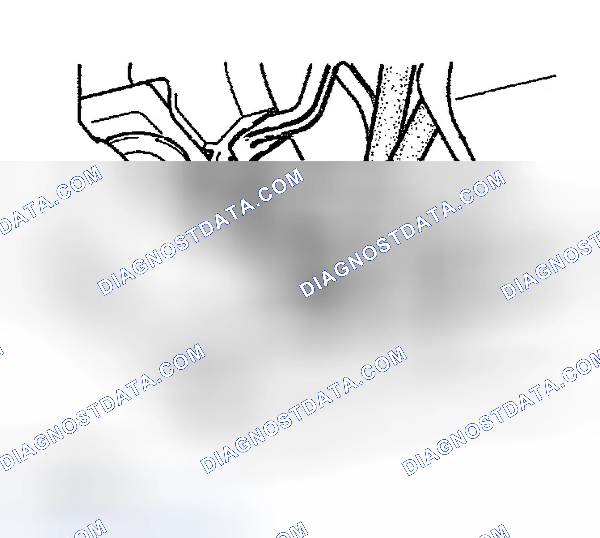 Scheme 267: INSTALLATION