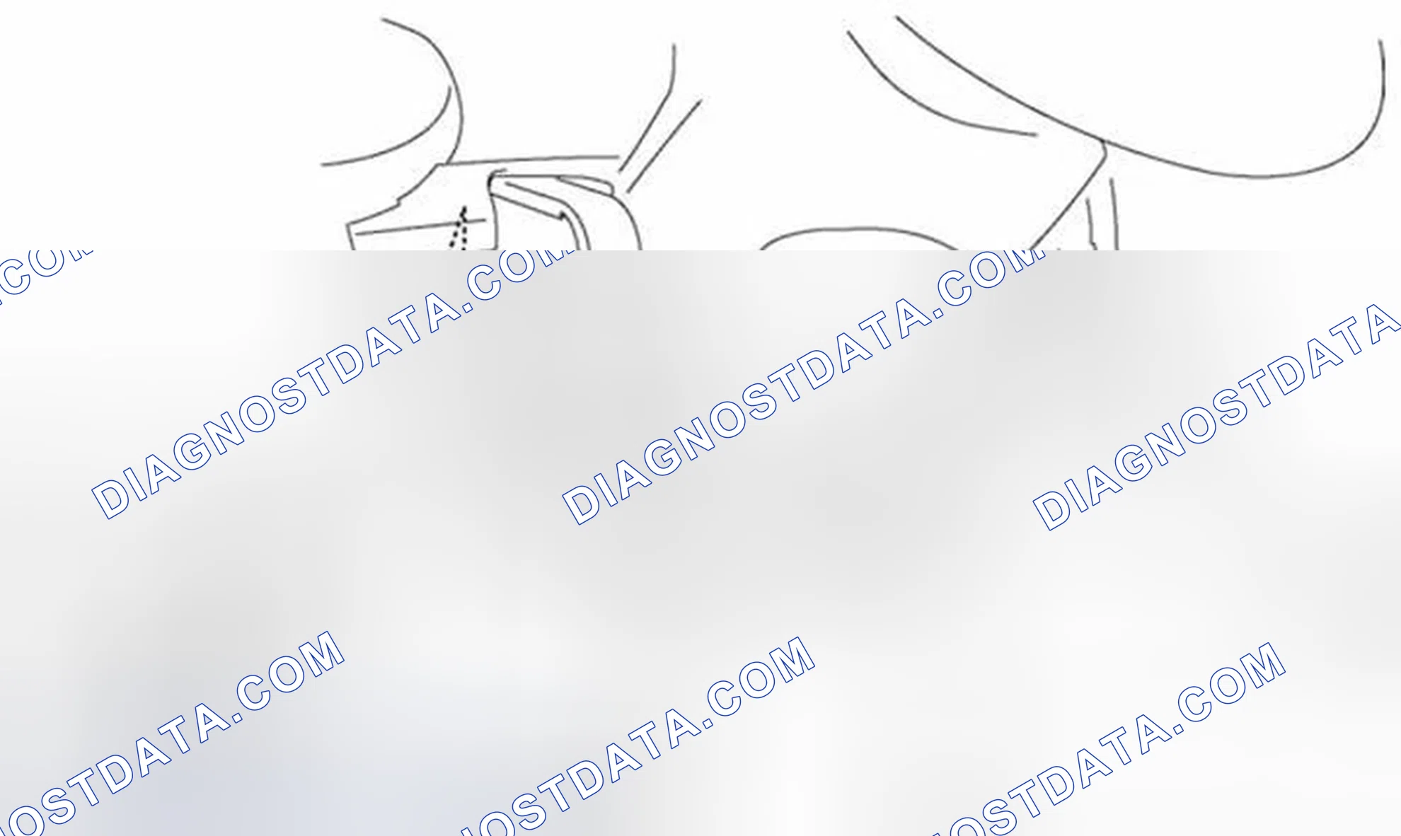 Scheme 117: KNEE BOLSTER REMOVAL/INSTALLATION