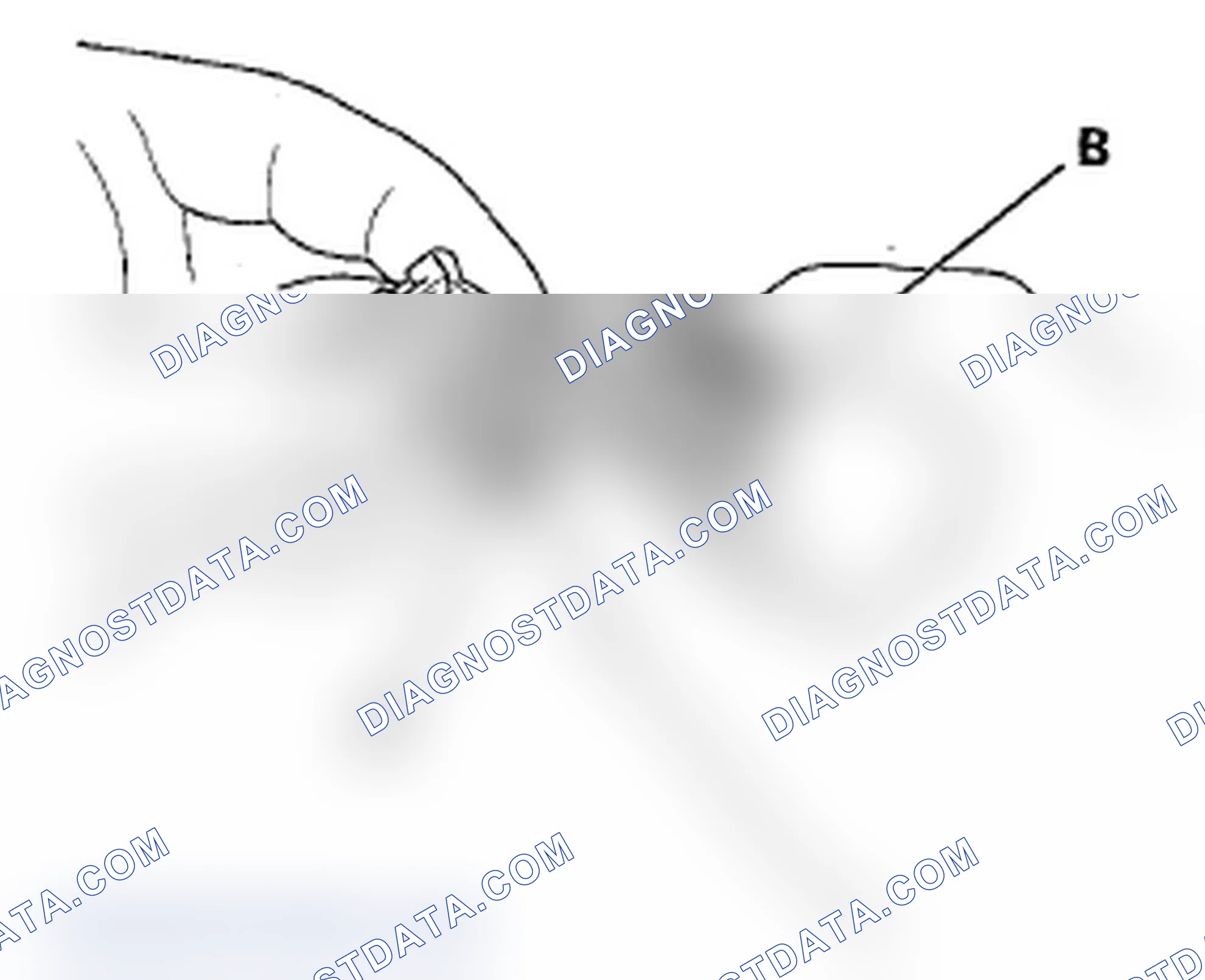 Scheme 283: Disconnecting