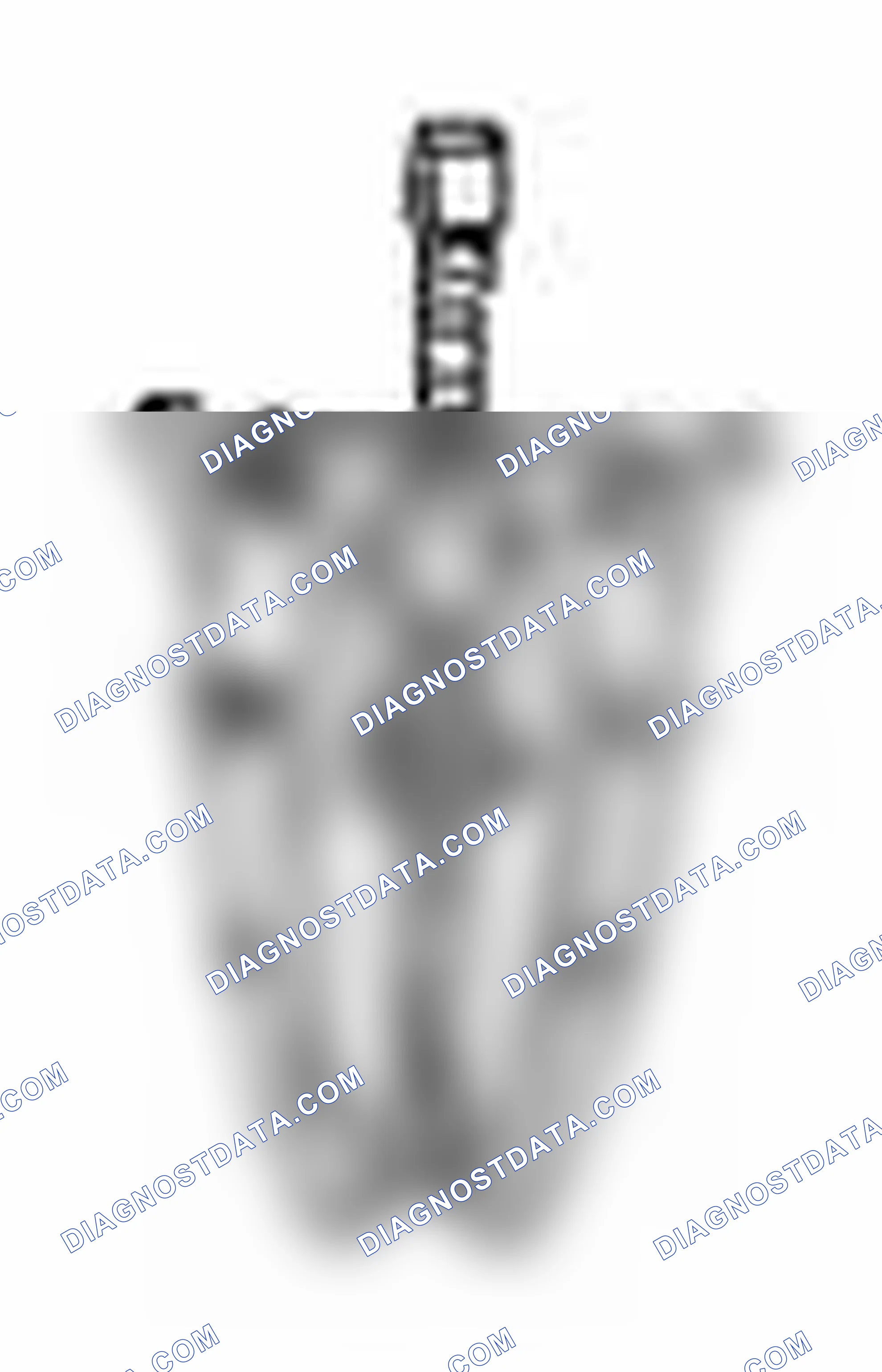 Scheme 482: Special Tool