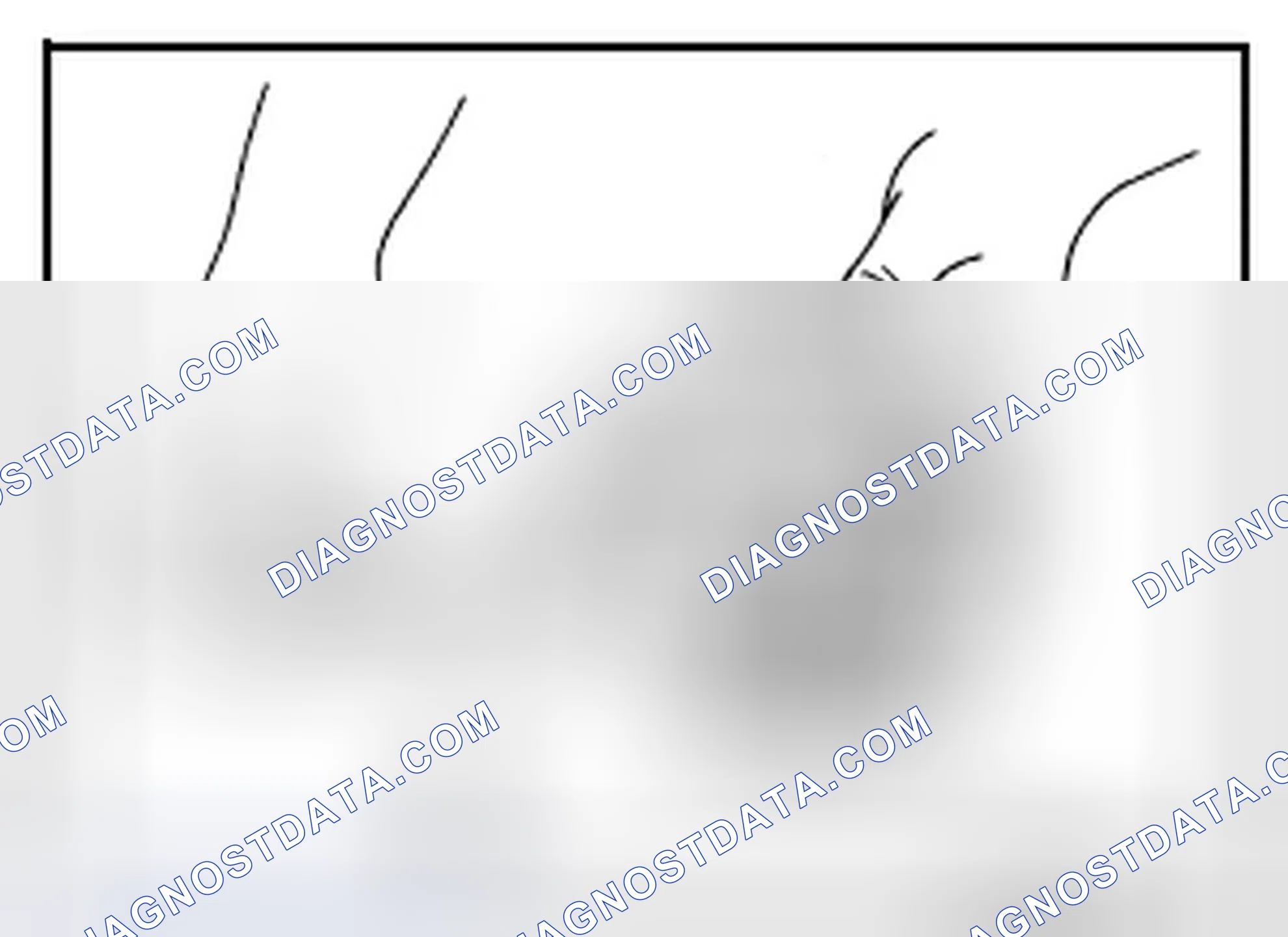 Scheme 237: Piston Skirt Diameter