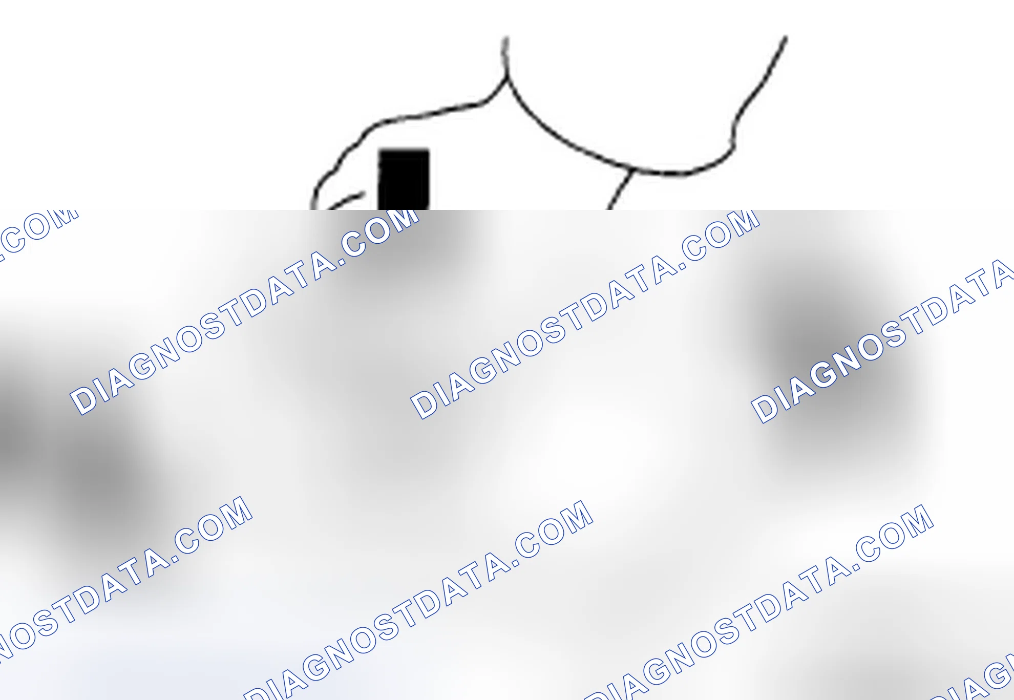 Scheme 286: INSTALLATION