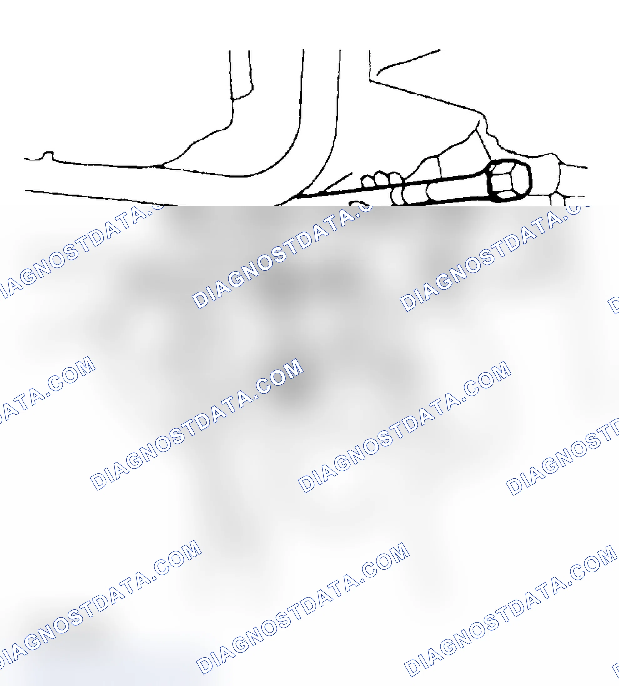 Scheme 63: Installation Procedure